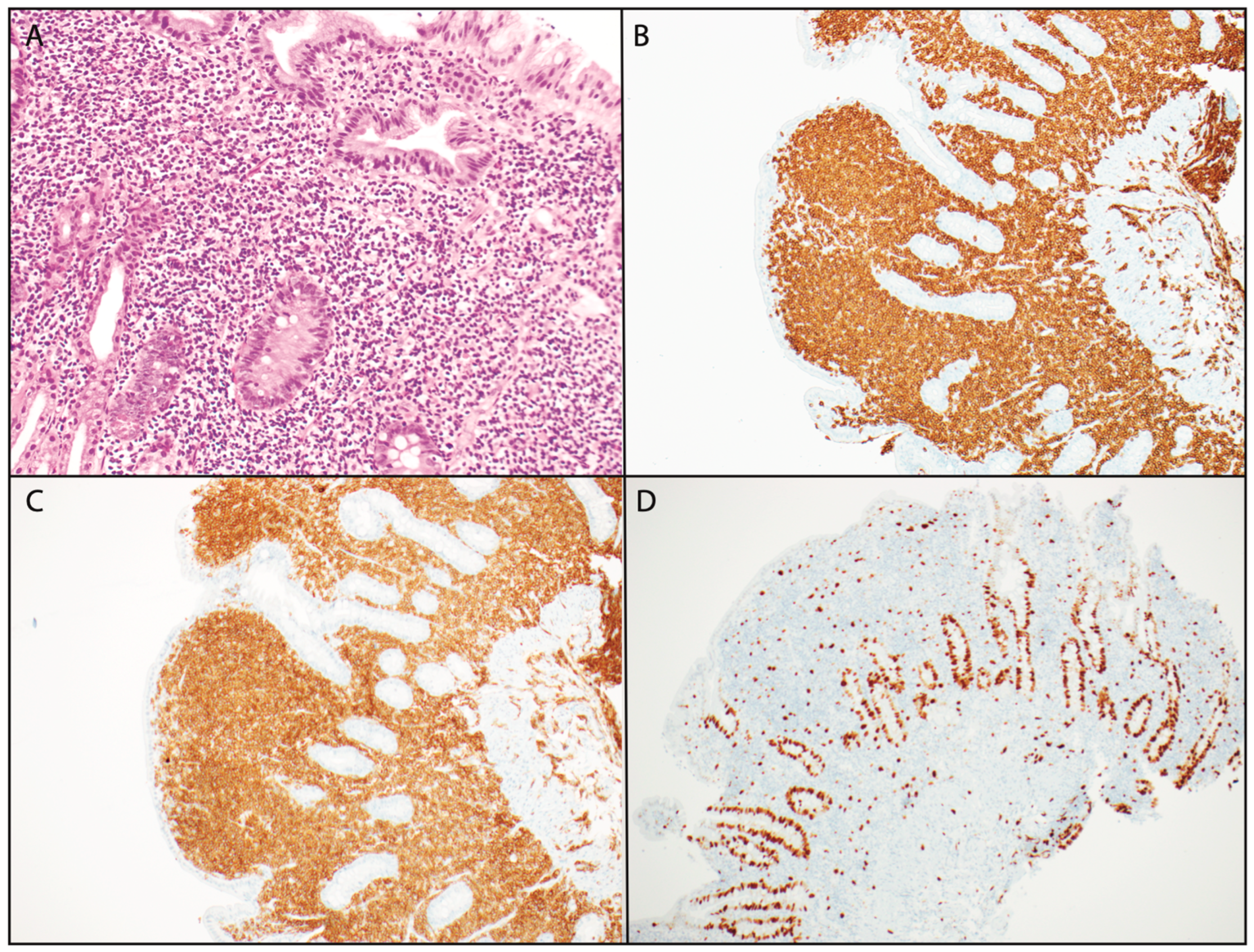 Hematolrep 16 00018 g001