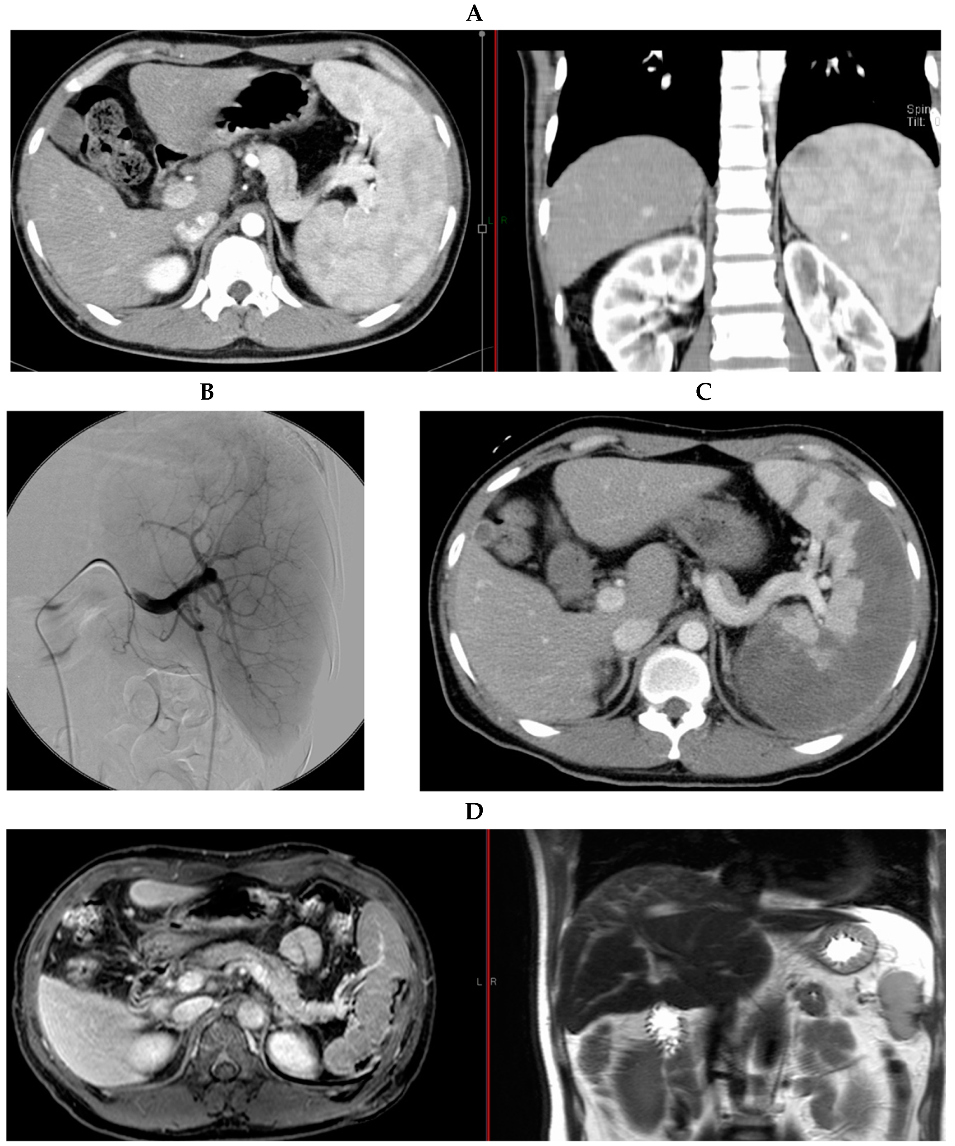 Hematolrep 16 00019 g001