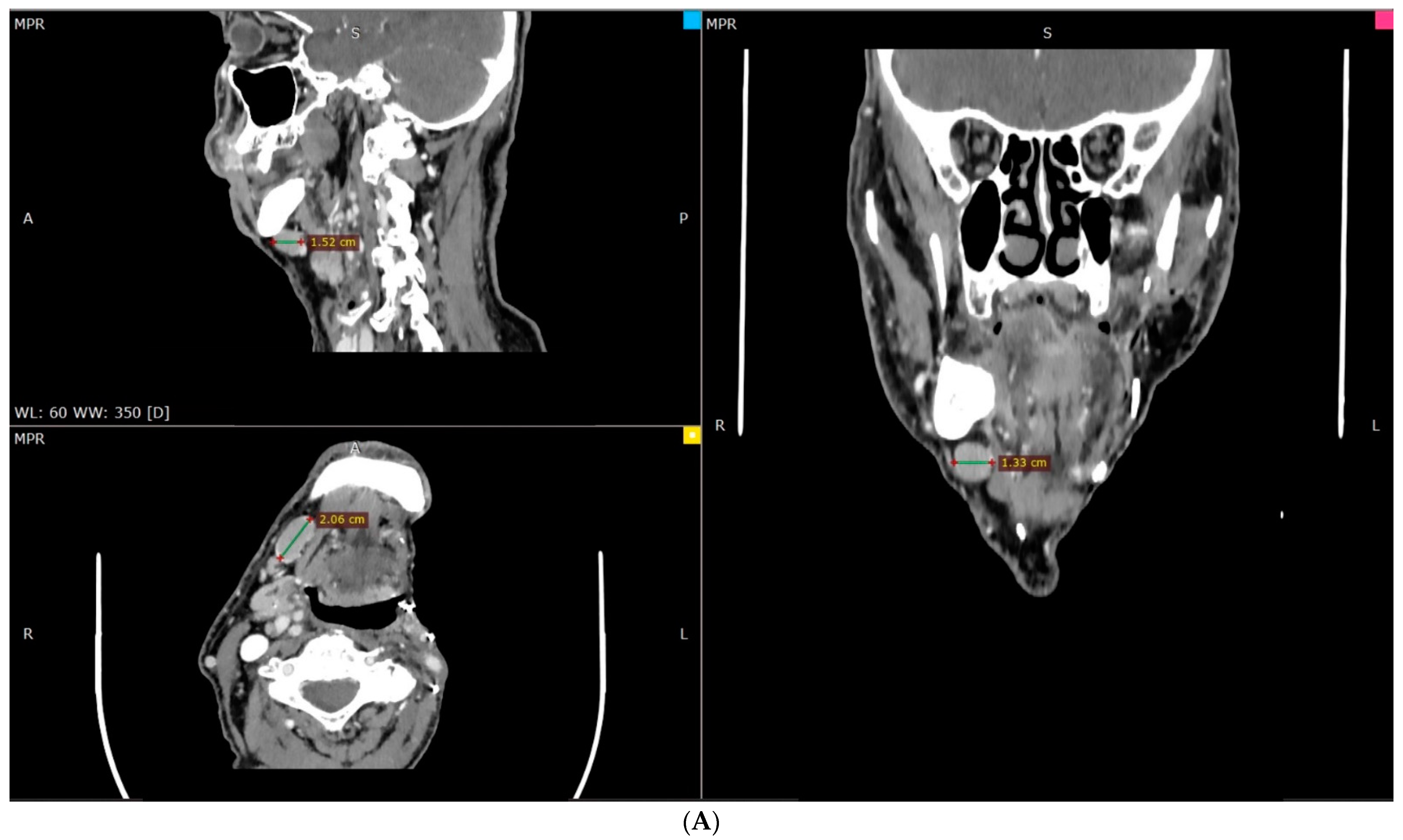 Hematolrep 16 00026 g002a