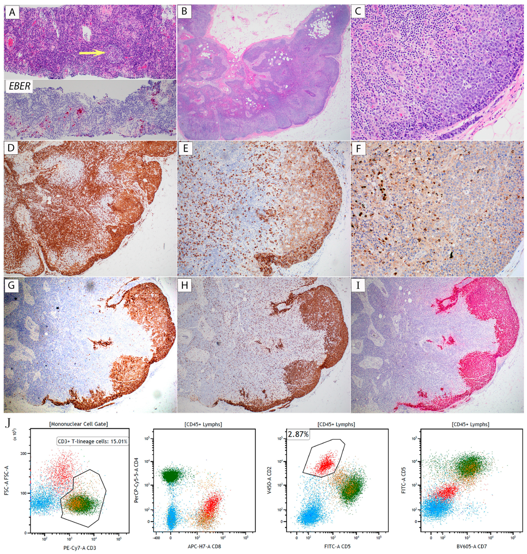 Hematolrep 16 00031 g001