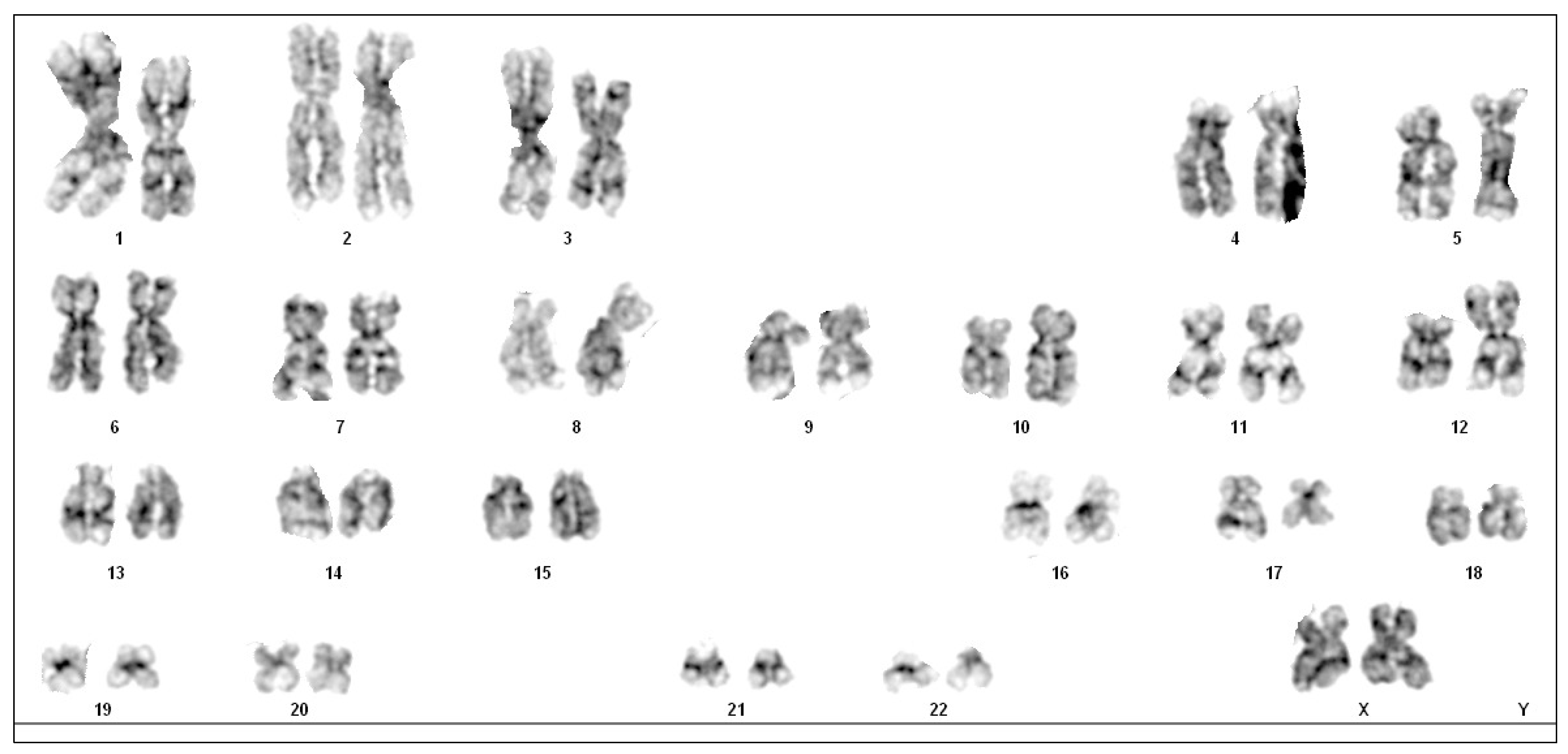 Hematolrep 16 00037 g002