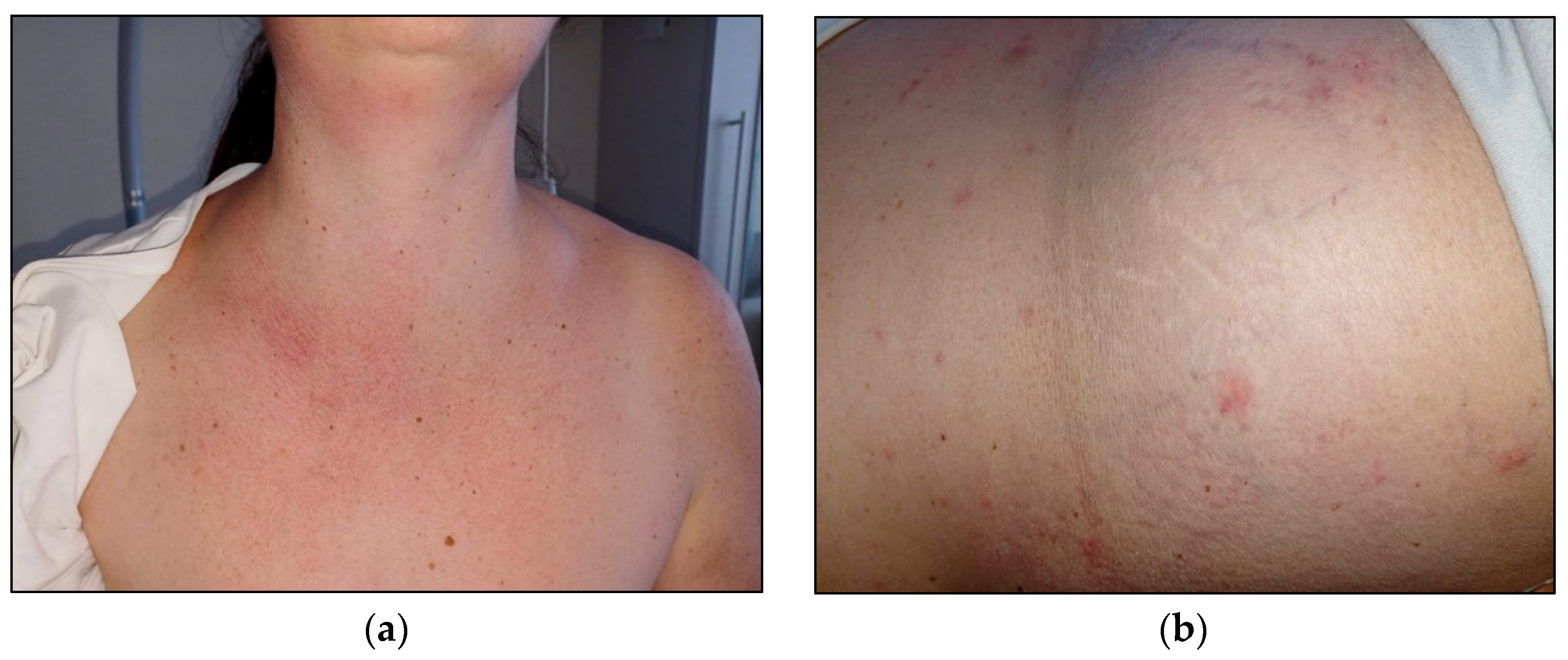 Hematolrep 16 00037 g003