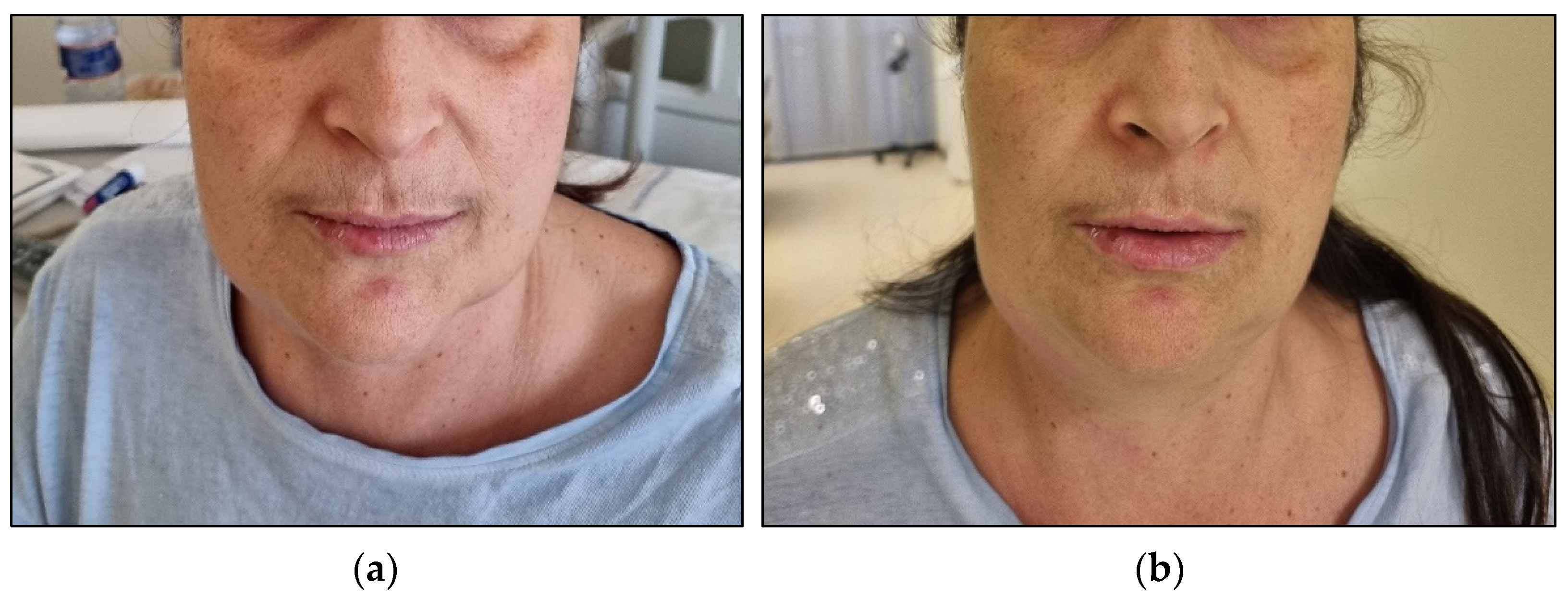 Hematolrep 16 00037 g004