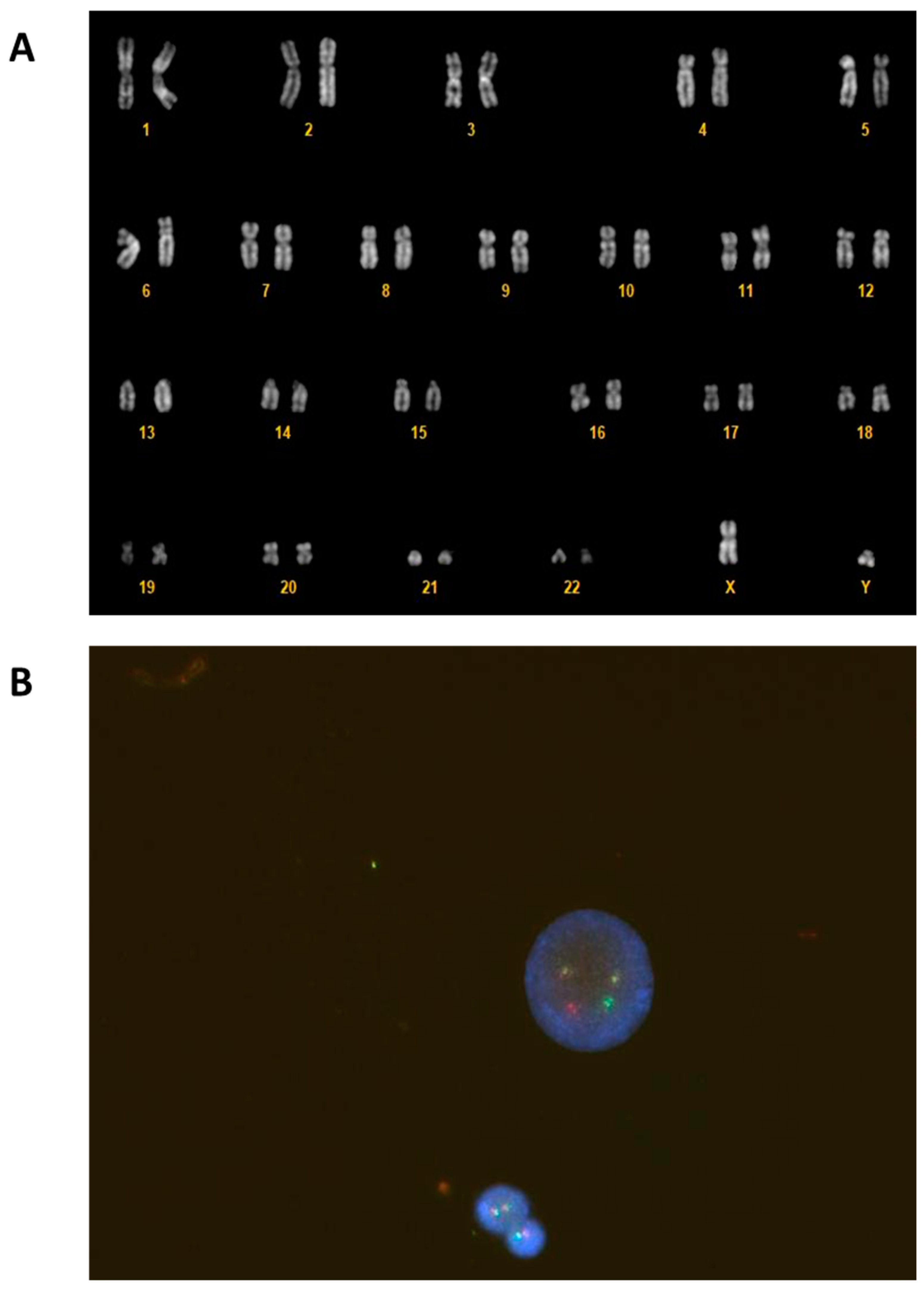 Hematolrep 16 00040 g002