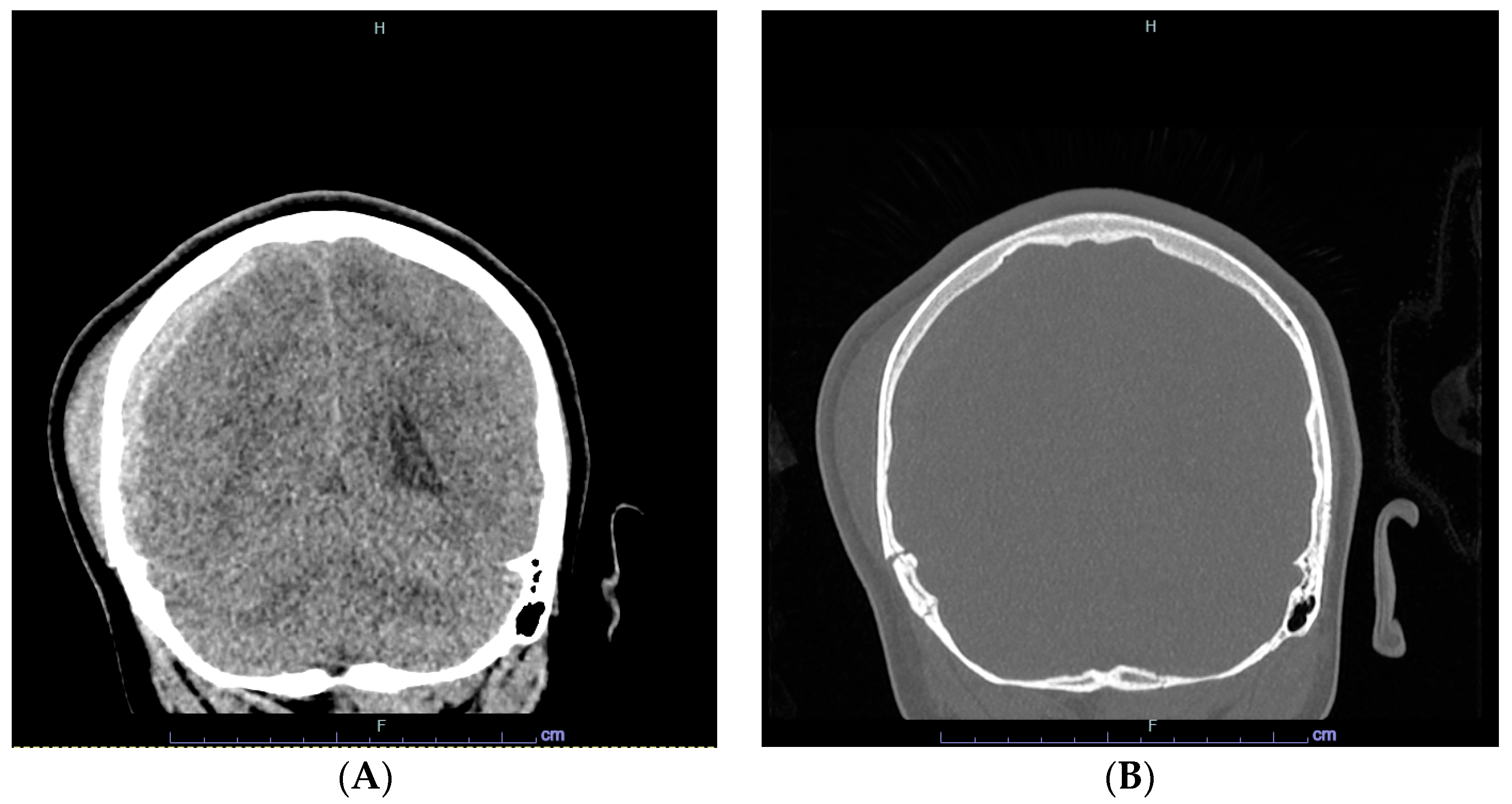 Hematolrep 16 00042 g001
