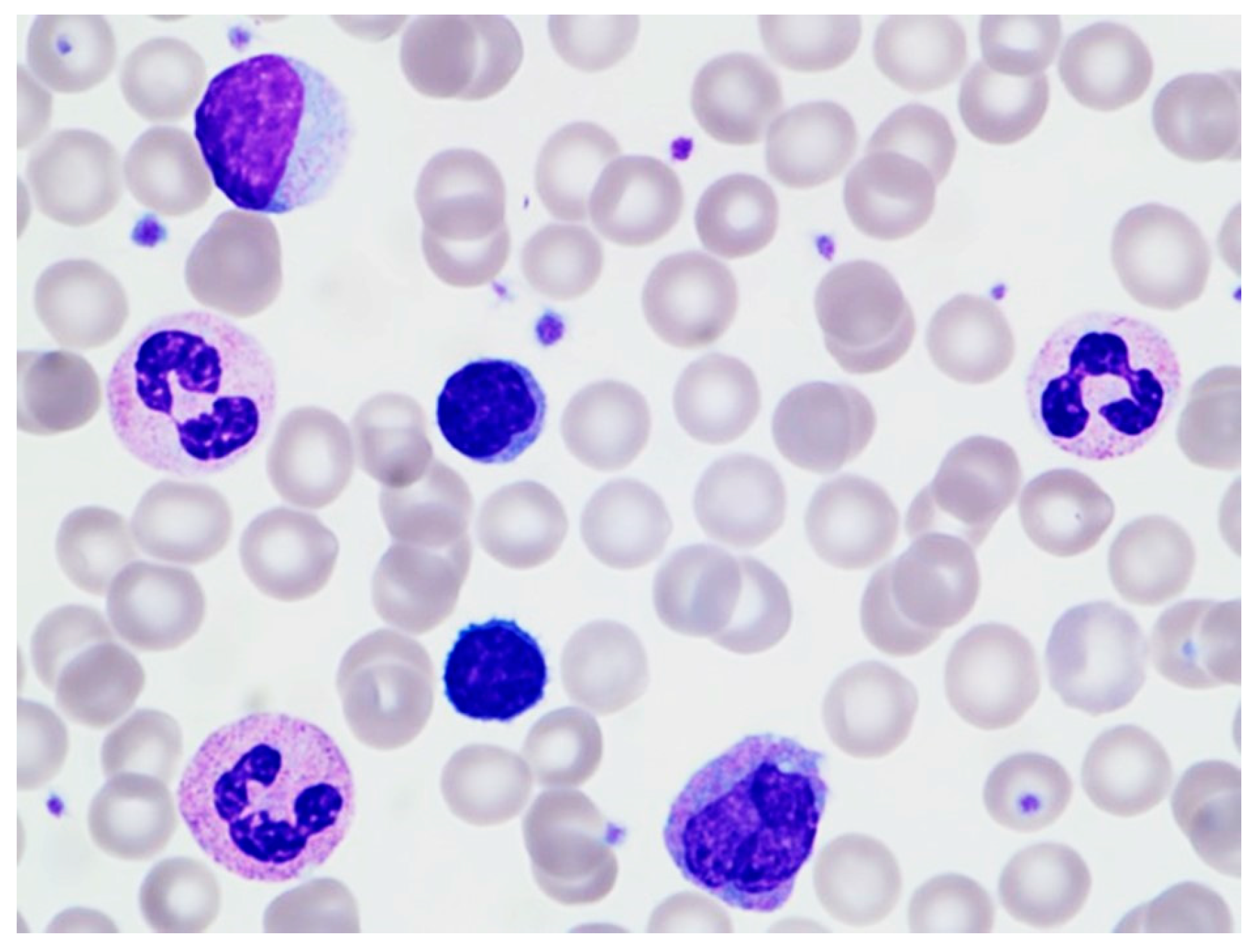 Hematolrep 16 00042 g002