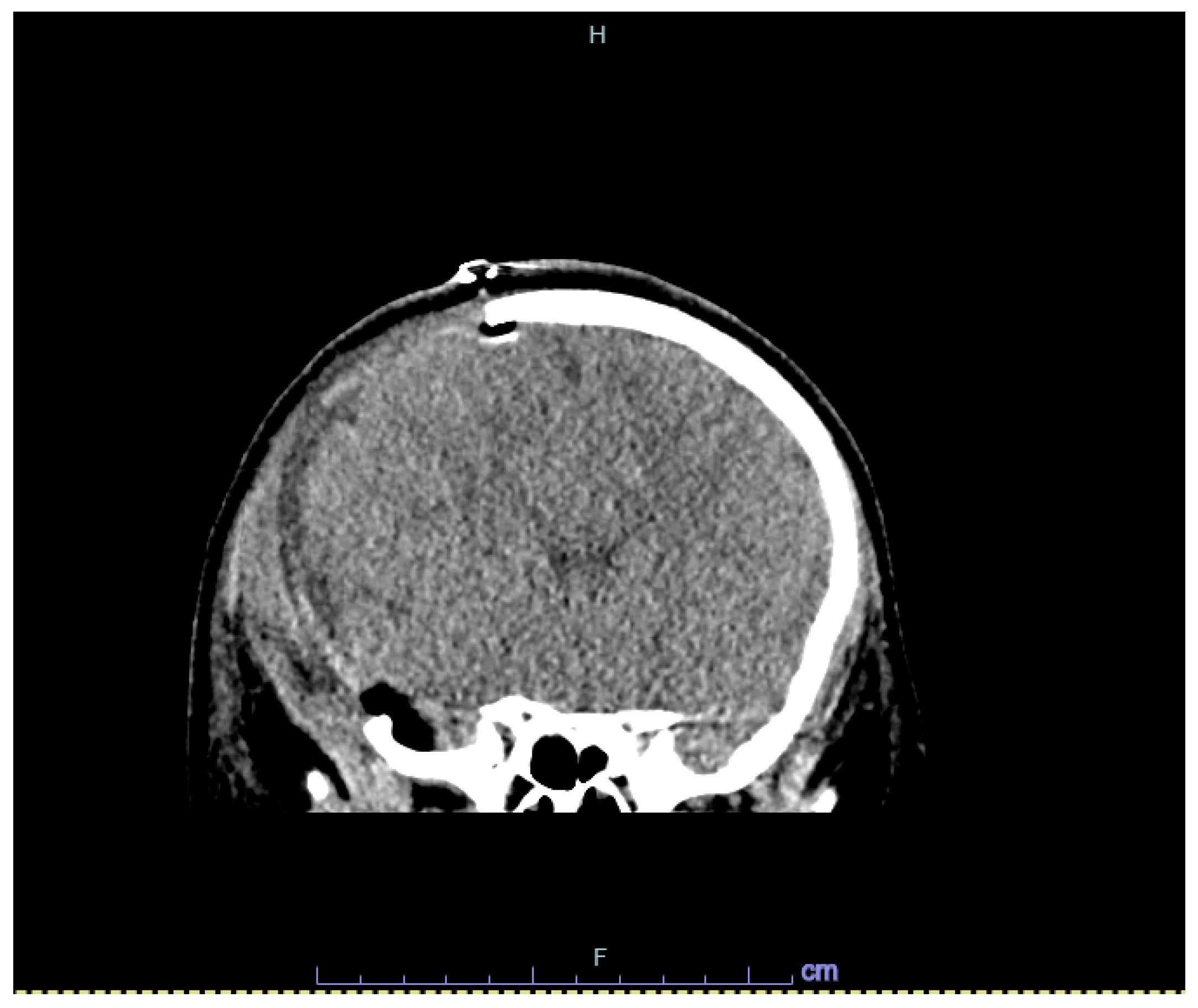 Hematolrep 16 00042 g005