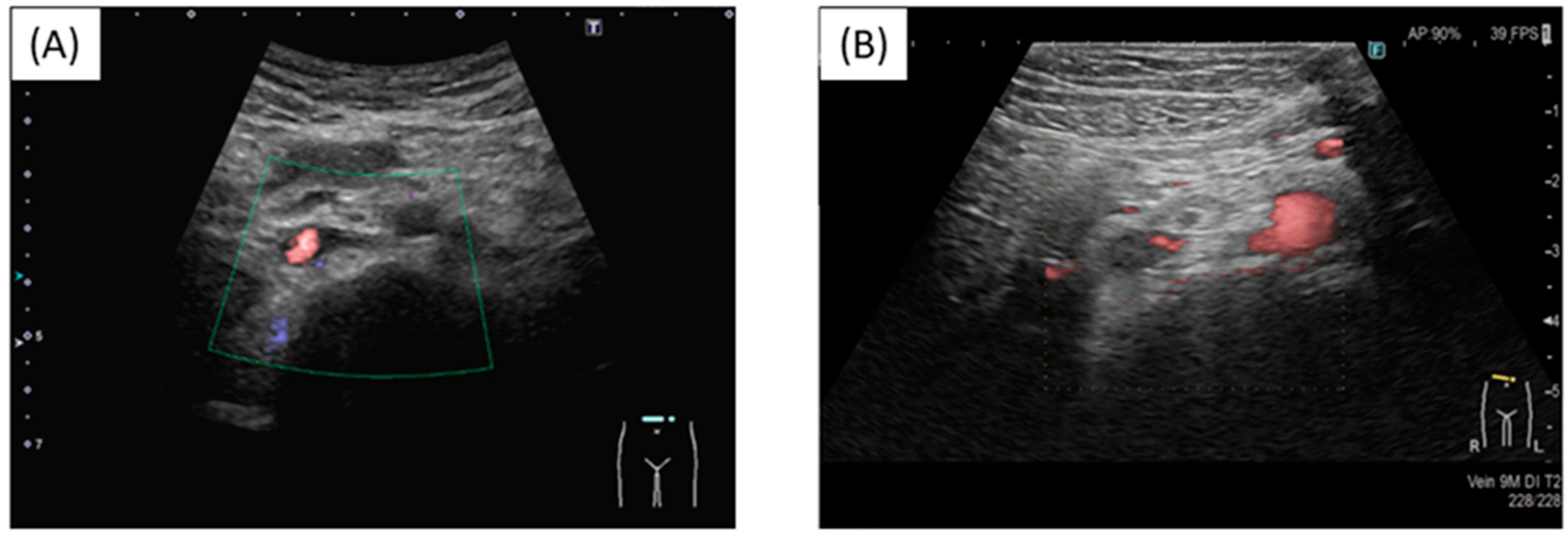 Hematolrep 16 00048 g004