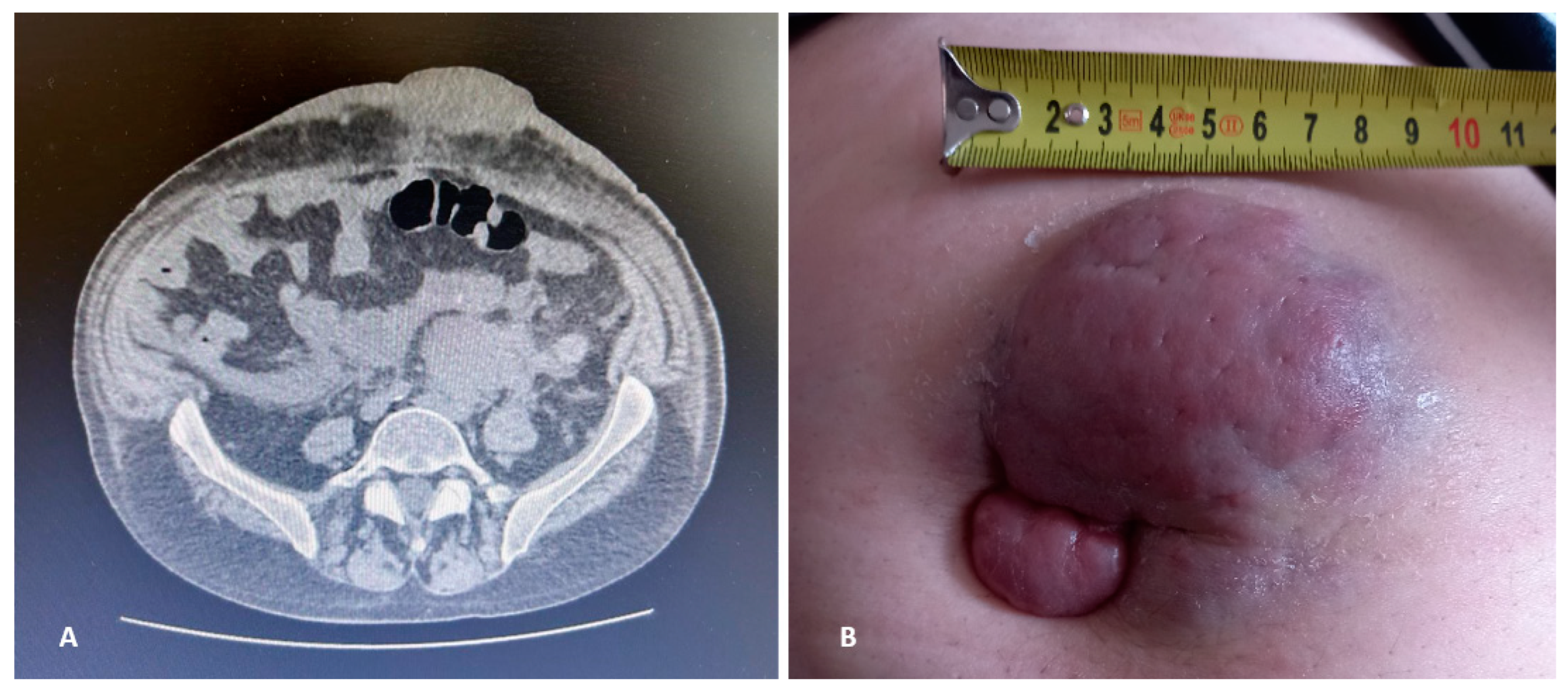 Hematolrep 16 00052 g001
