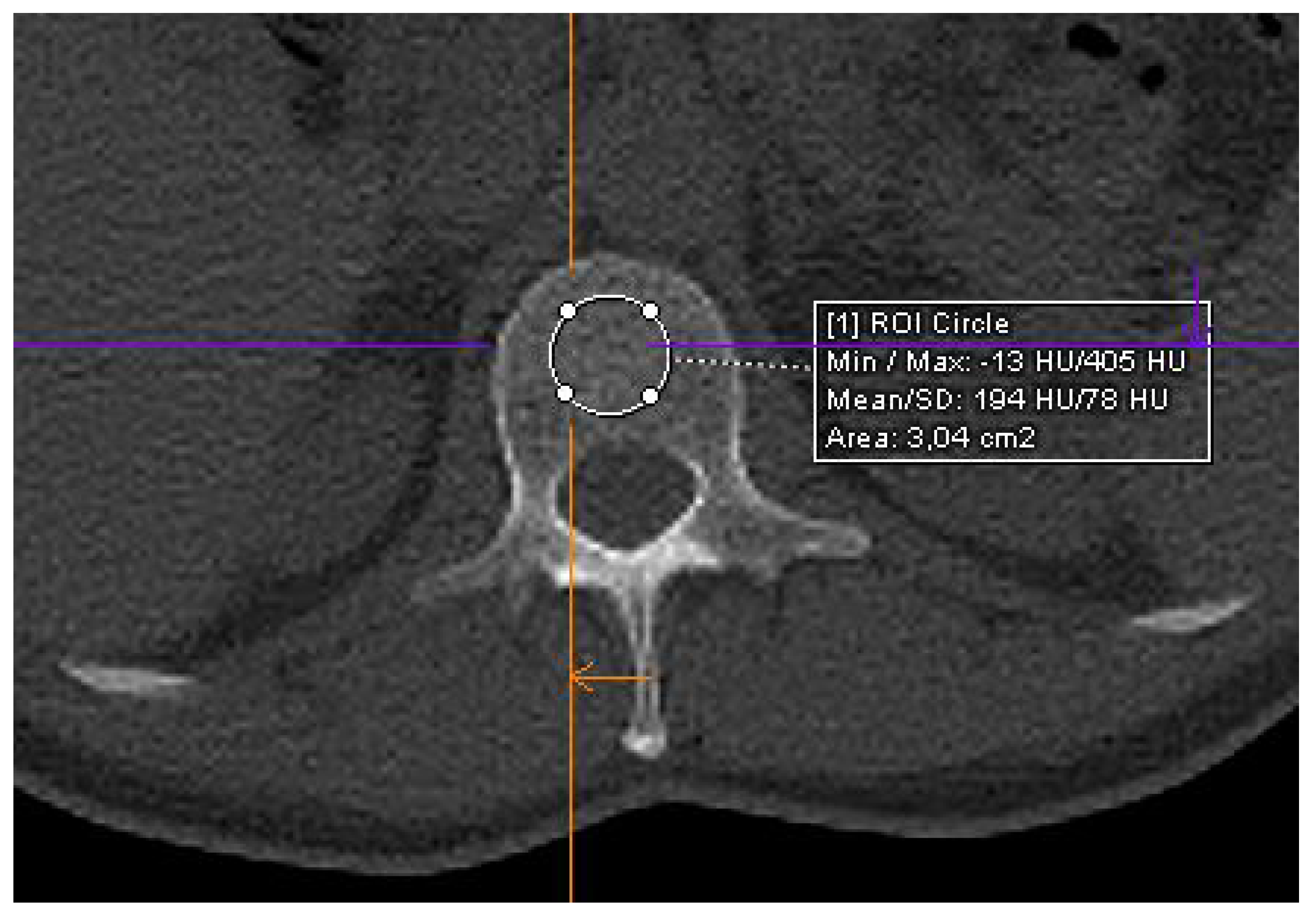 Hematolrep 16 00061 g001