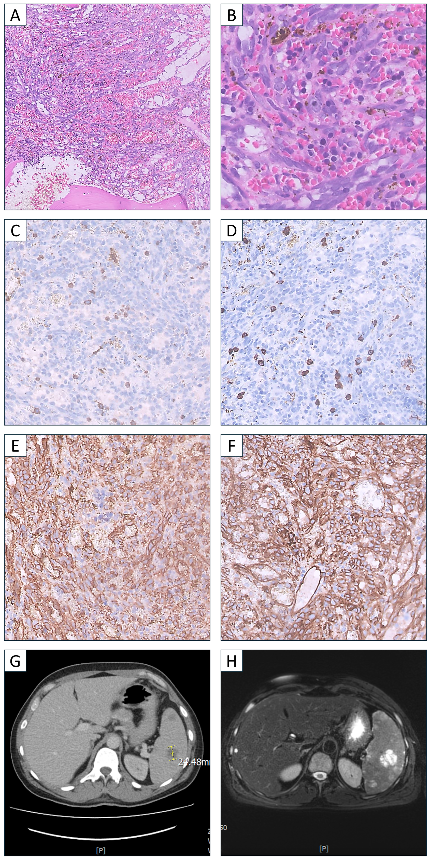 Hematolrep 16 00063 g001 Hematolrep 16 00063 g001