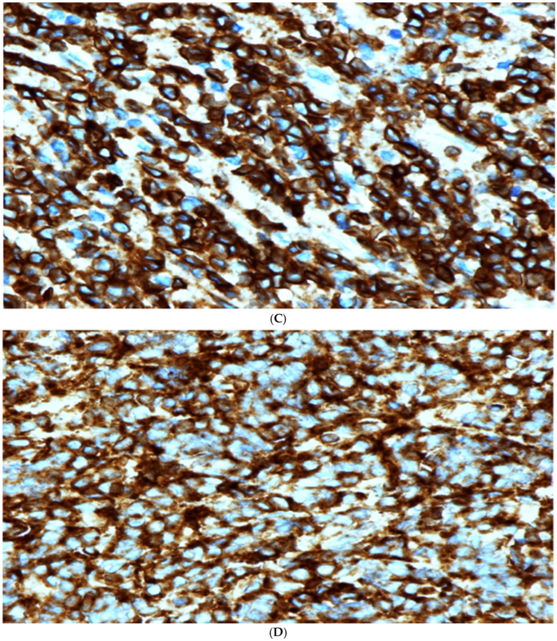 Hematolrep 16 00069 g002b Hematolrep 16 00069 g002b