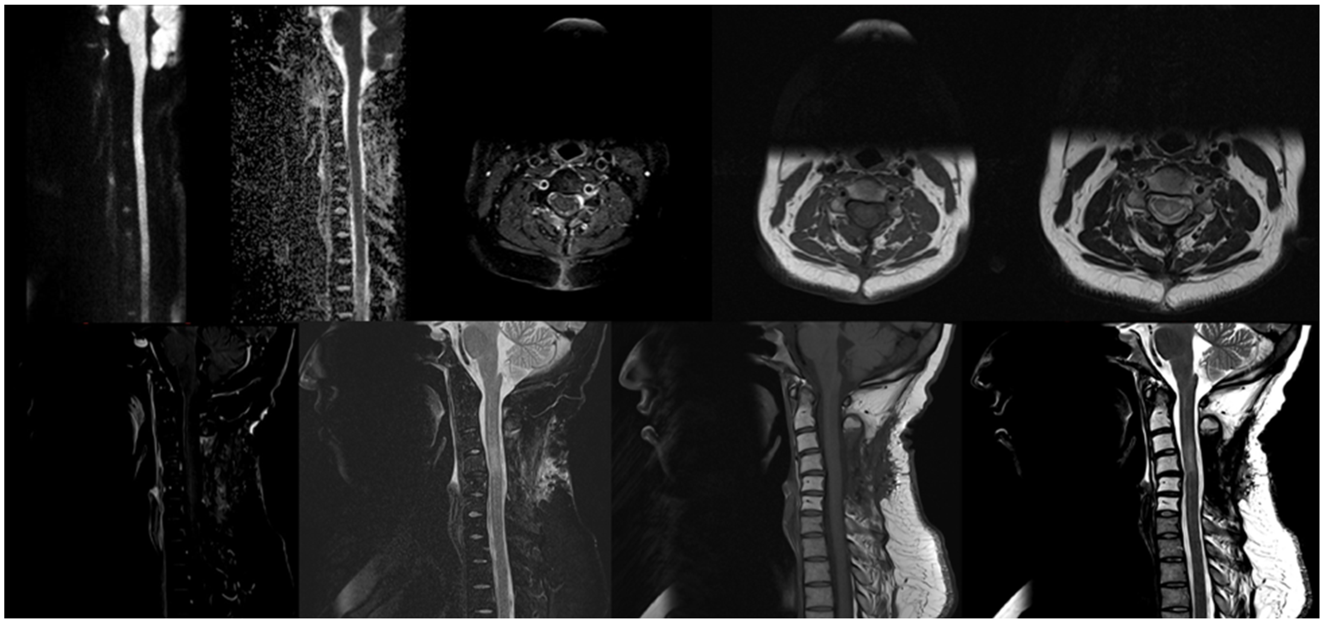 Hematolrep 16 00069 g003 Hematolrep 16 00069 g003