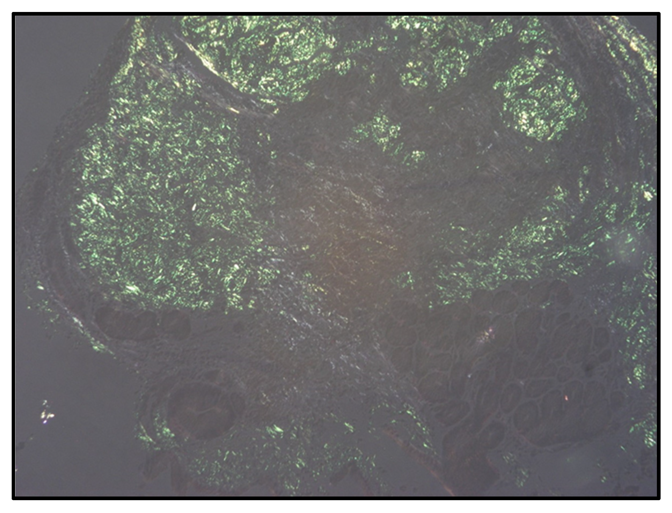 Hematolrep 17 00010 g002