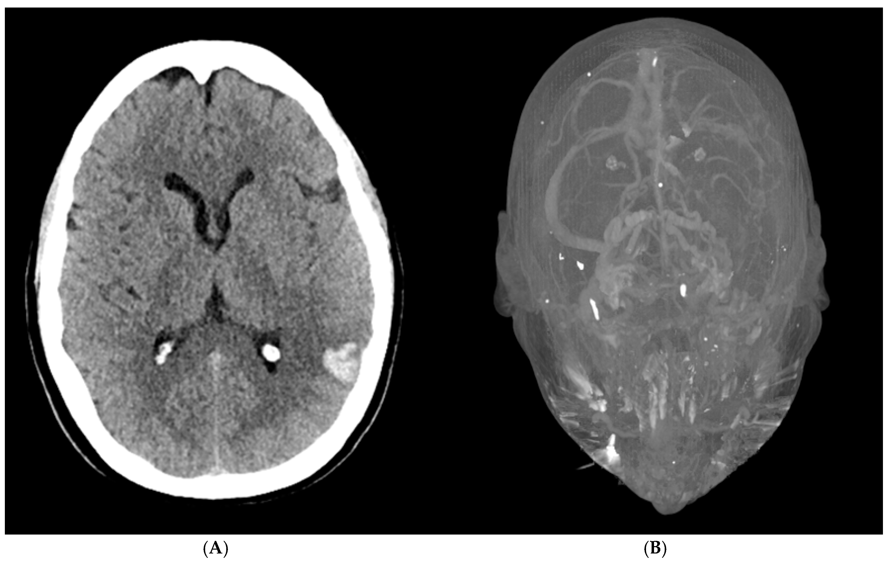 Hematolrep 17 00012 g001
