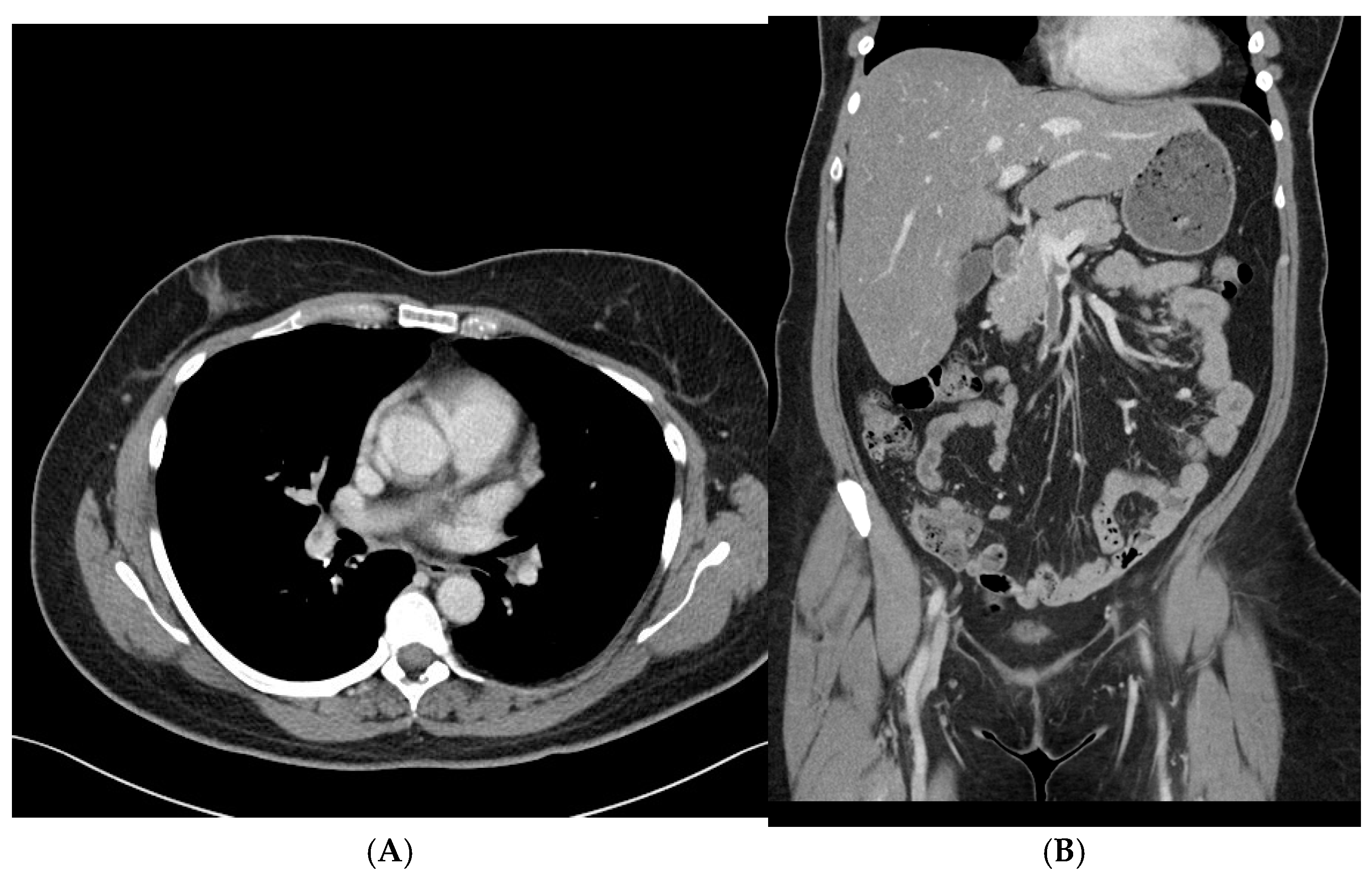 Hematolrep 17 00012 g002