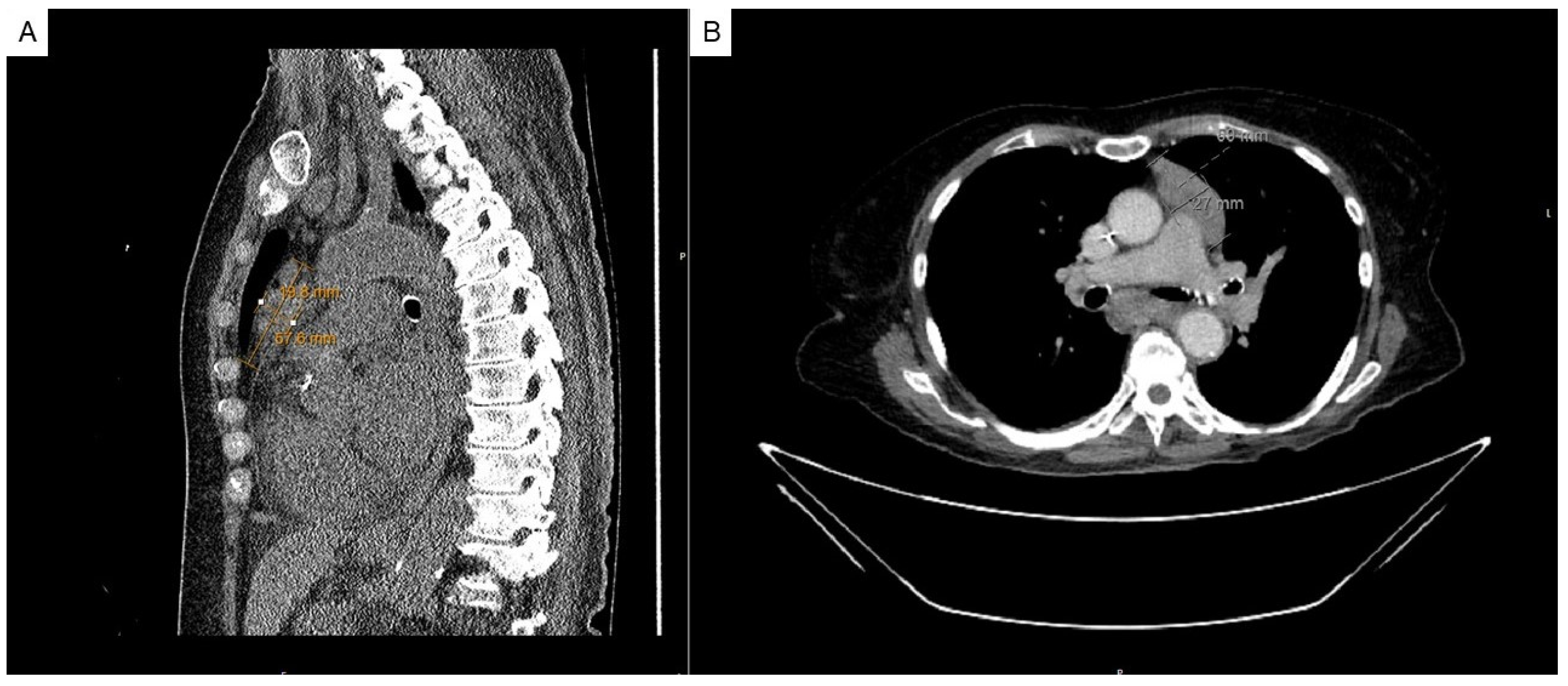 Hematolrep 17 00014 g001
