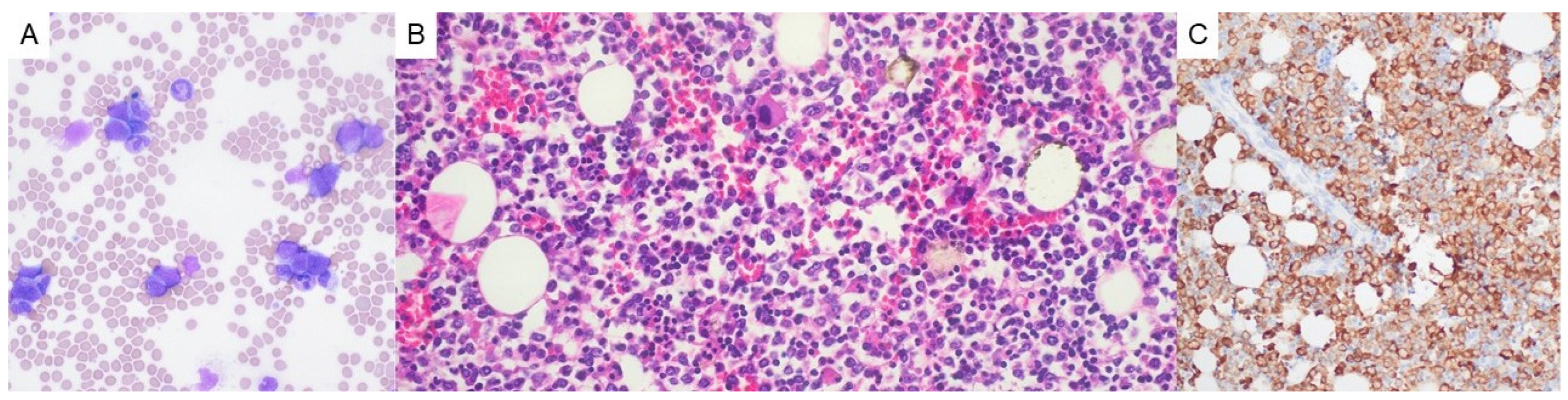 Hematolrep 17 00014 g003