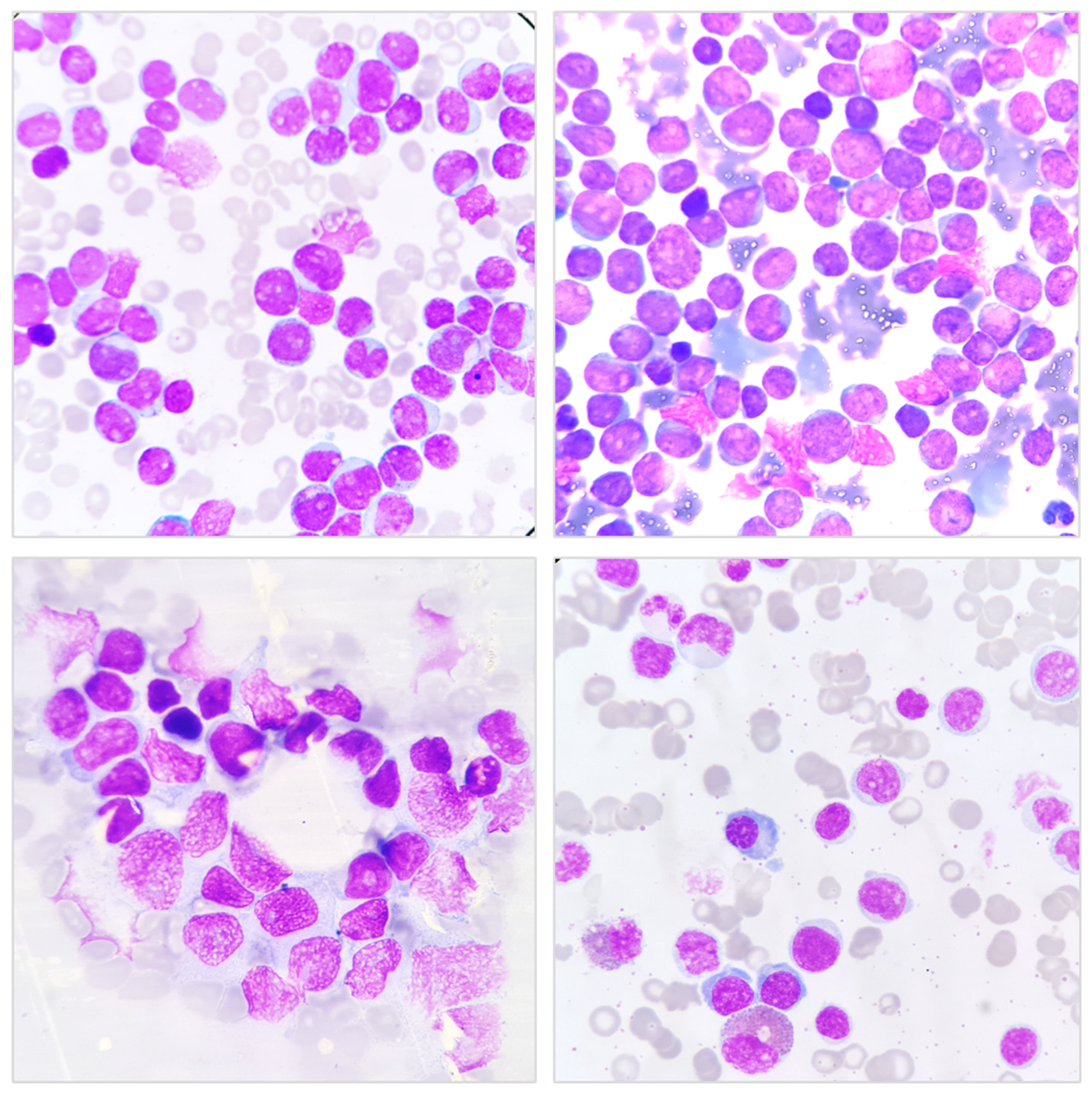 Hematolrep 17 00018 g001