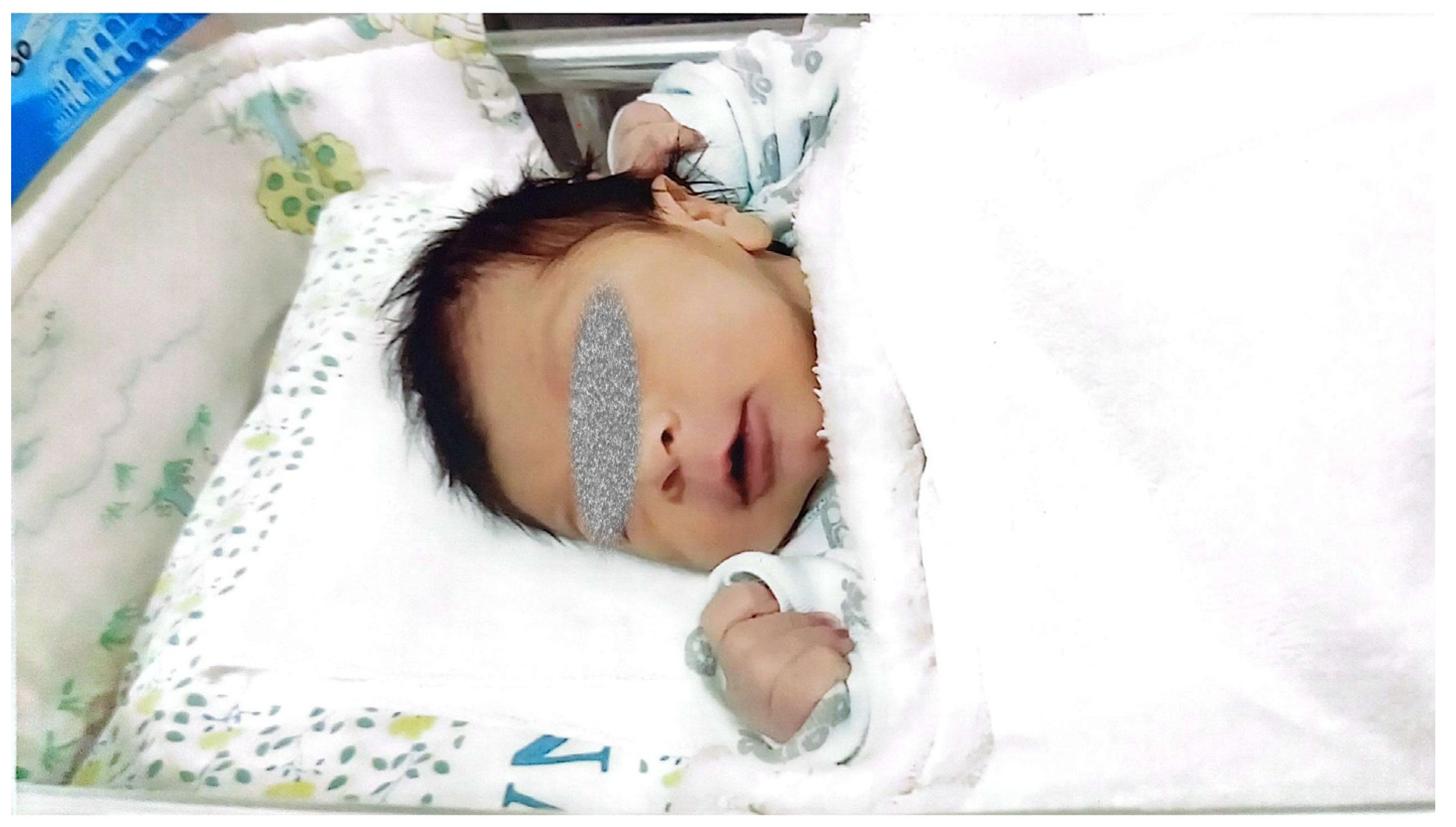 Hematolrep 17 00020 g002 Hematolrep 17 00020 g002