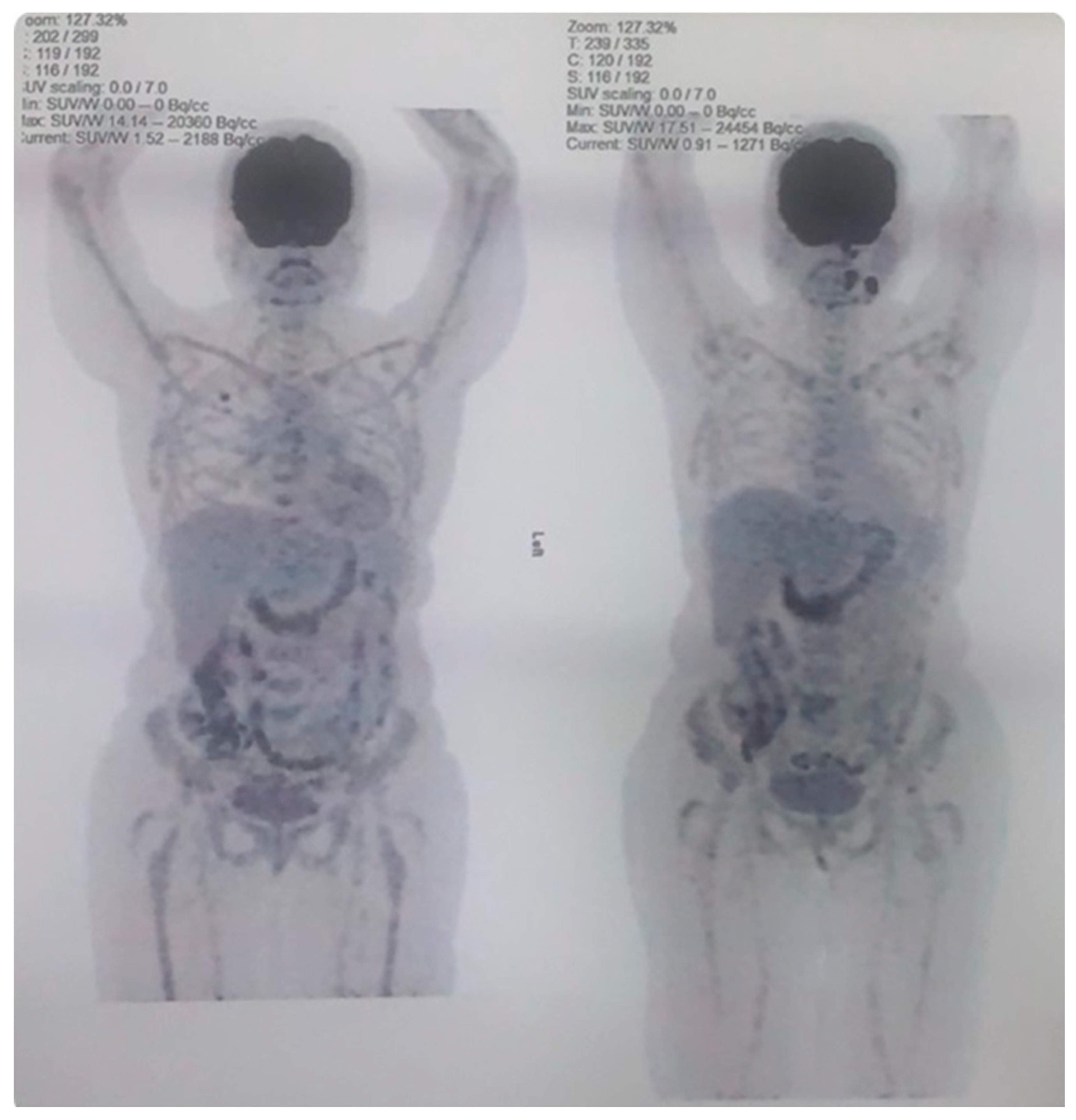 Hematolrep 17 00022 g002