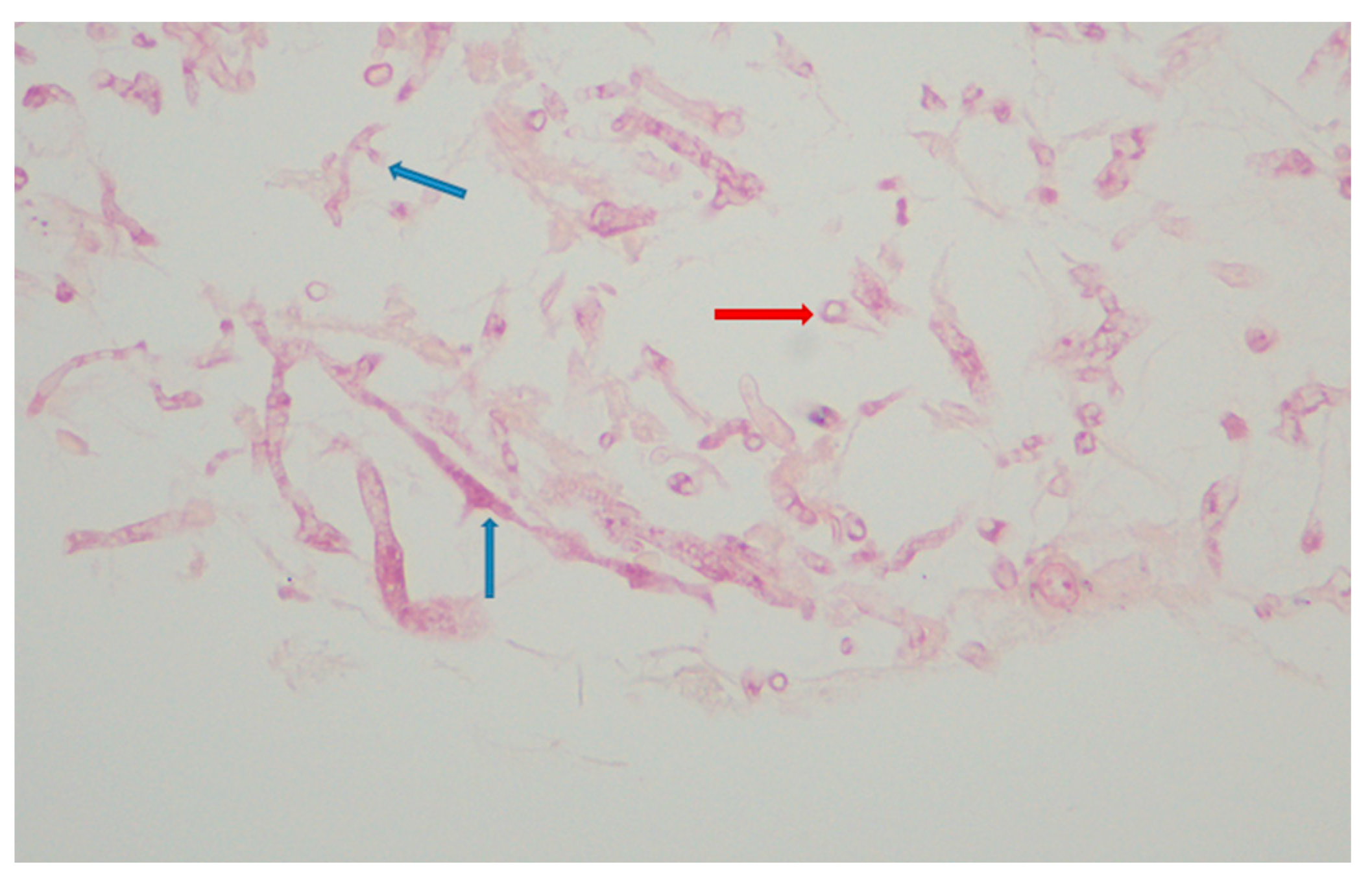 Hematolrep 17 00025 g004