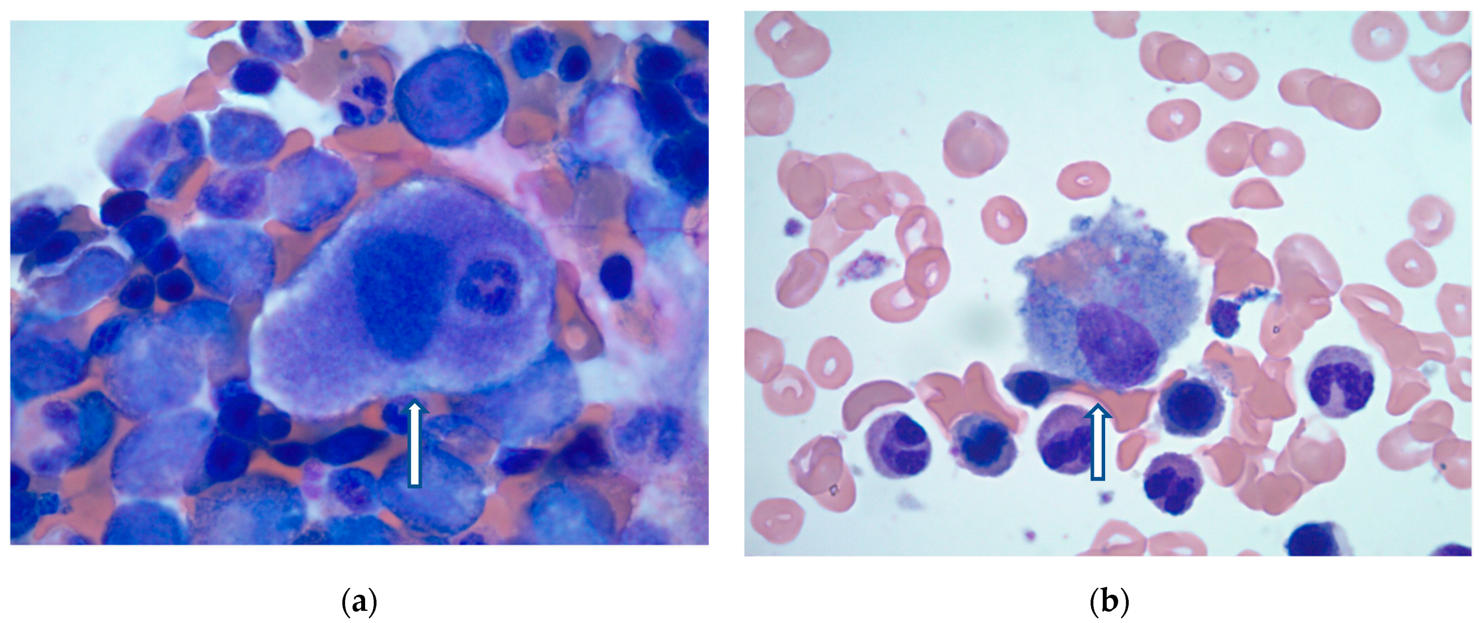 Hematolrep 17 00033 g001