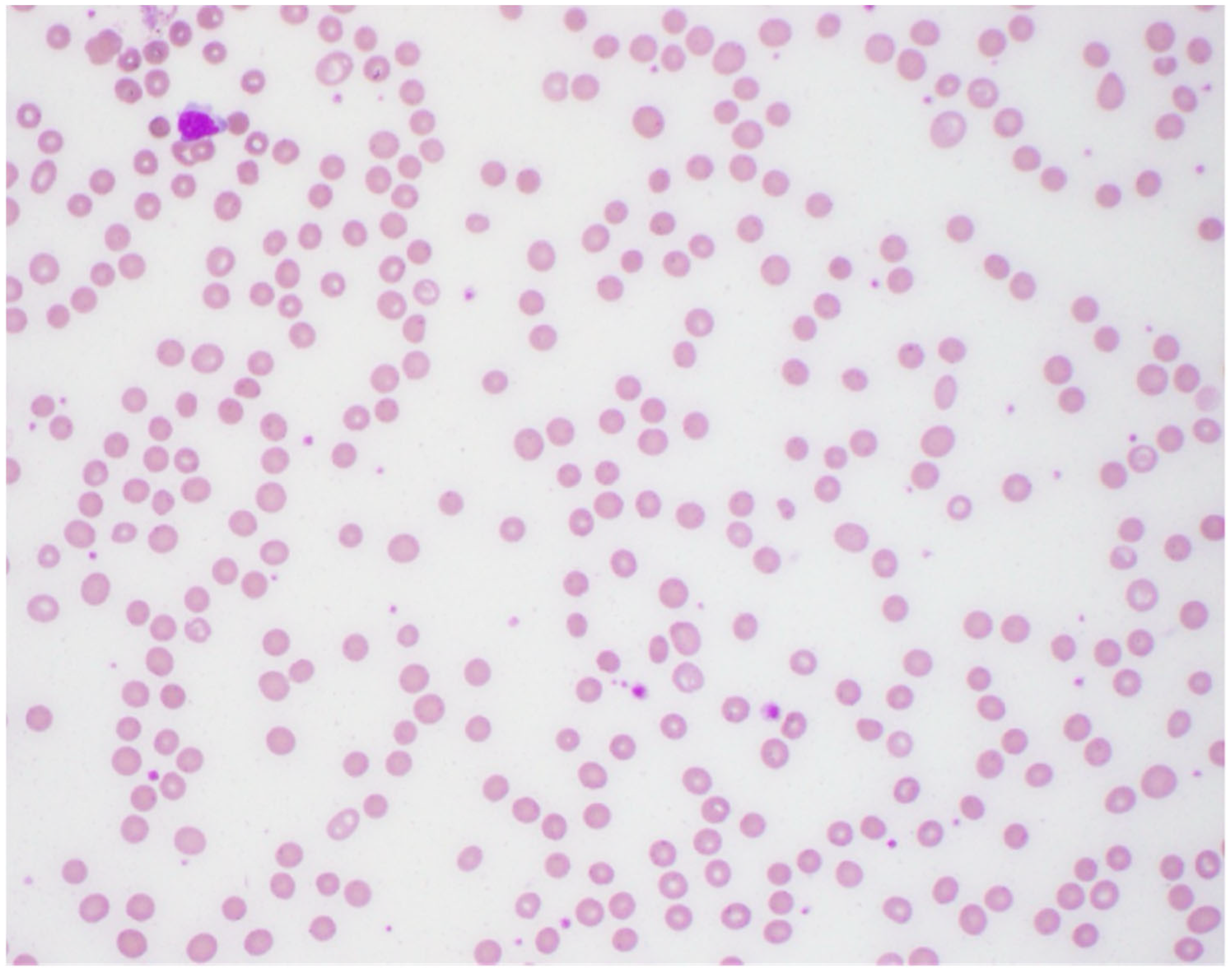 Hematolrep 17 00035 g001