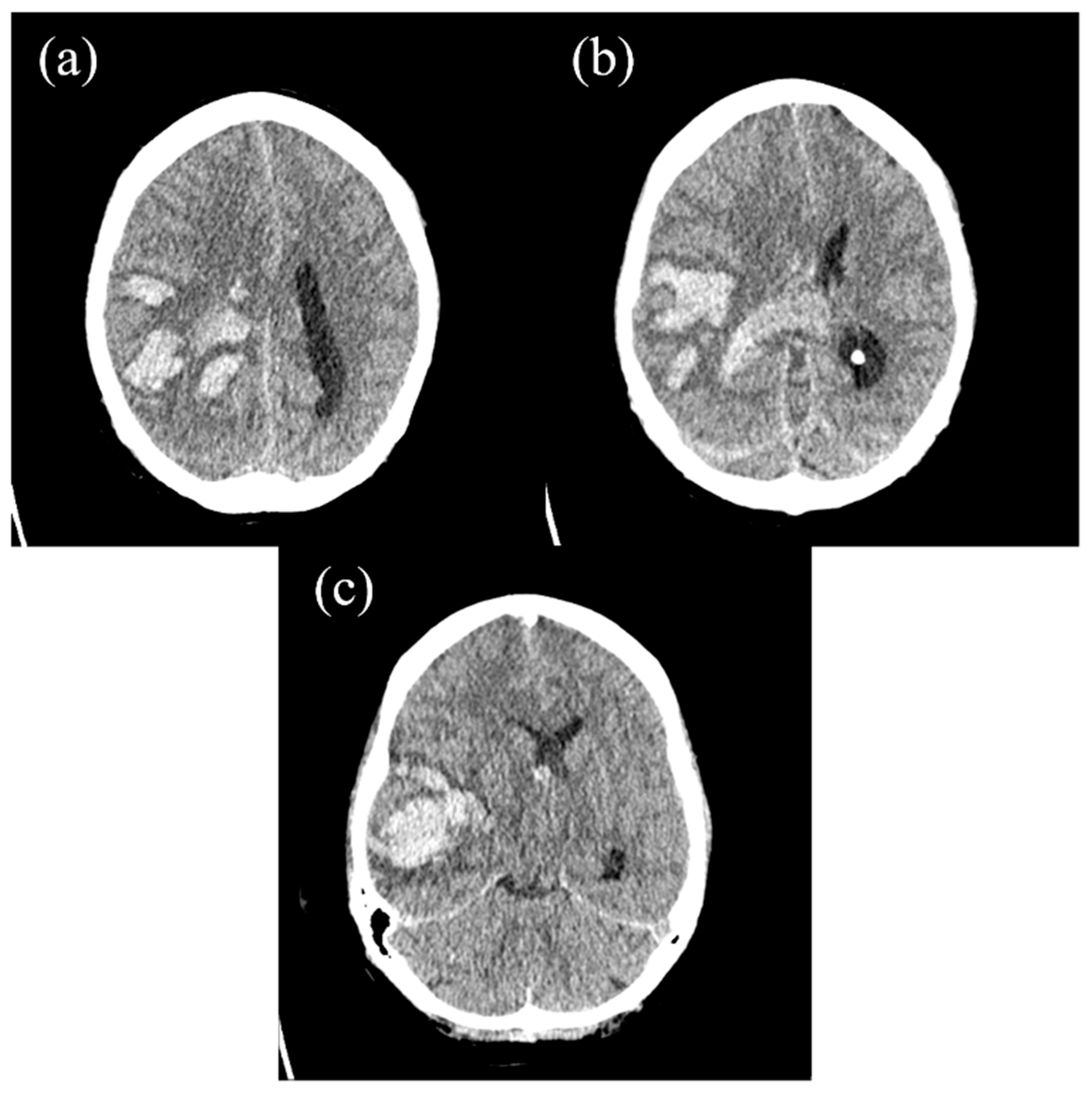 Hematolrep 17 00036 g001