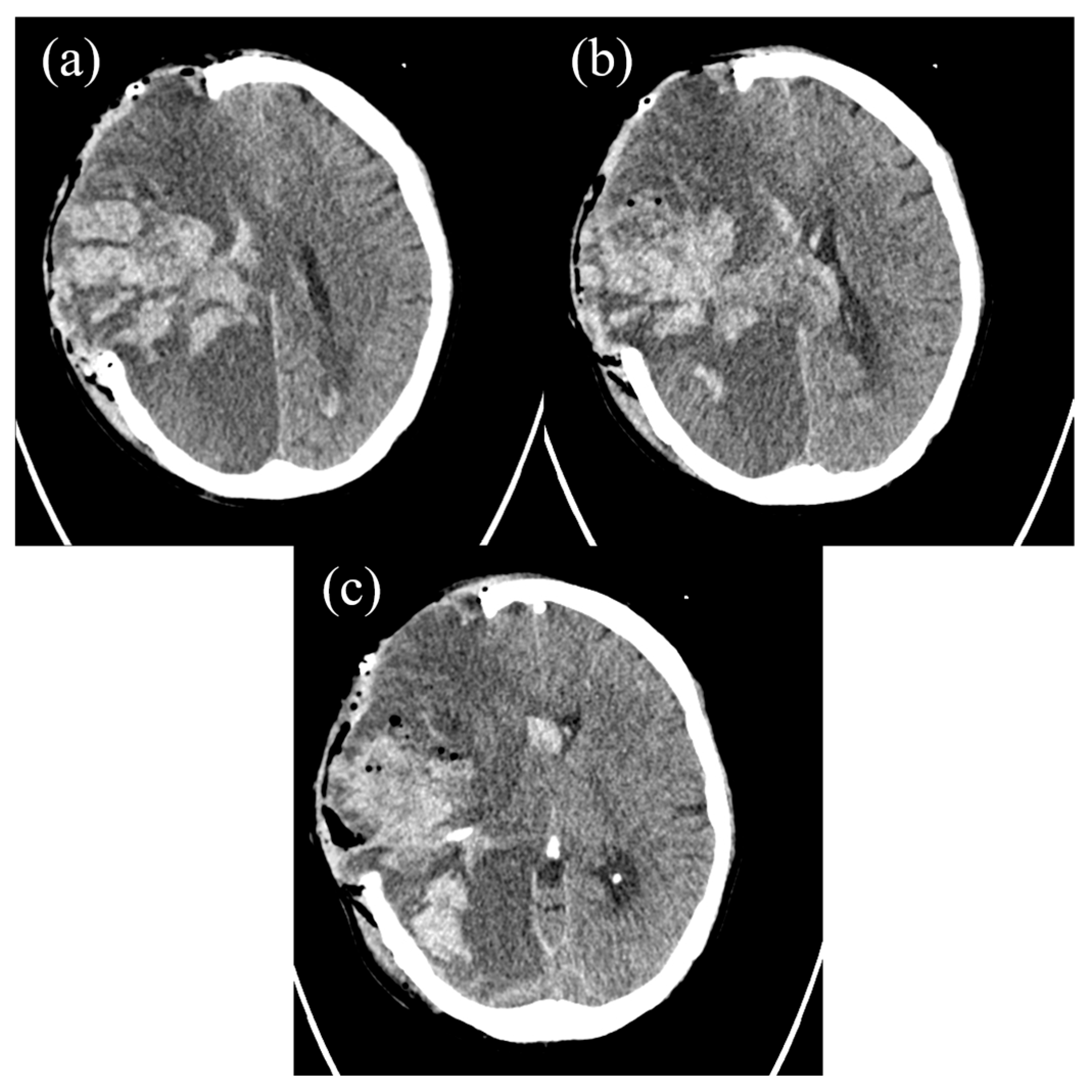 Hematolrep 17 00036 g003