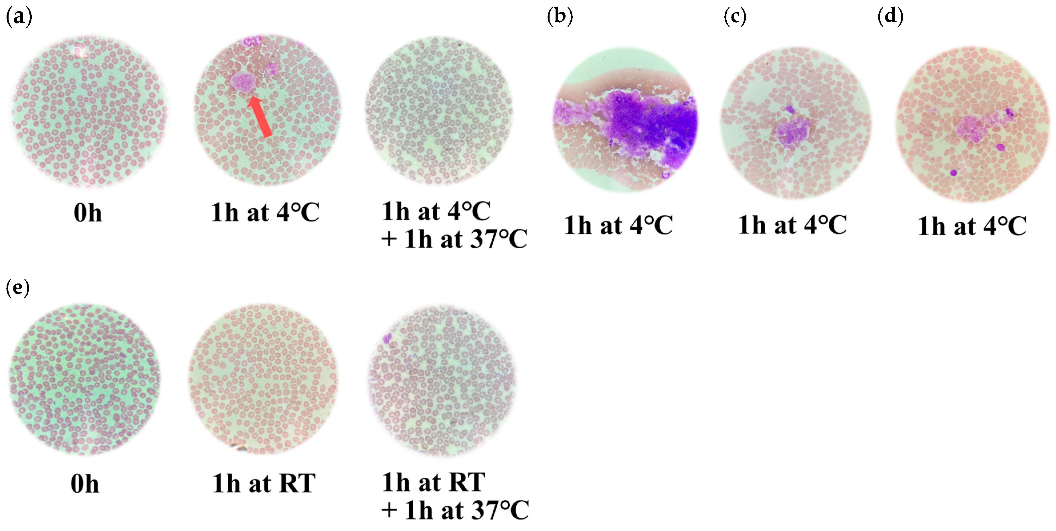 Hematolrep 17 00042 g002
