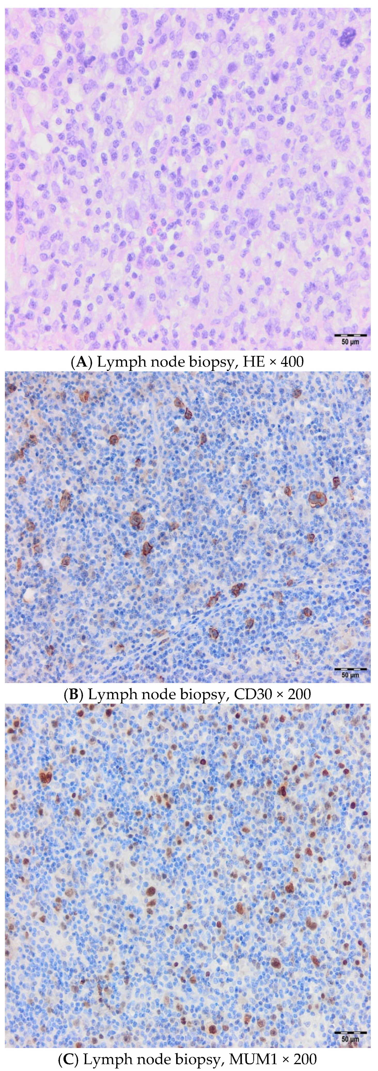 Hematolrep 17 00043 g001