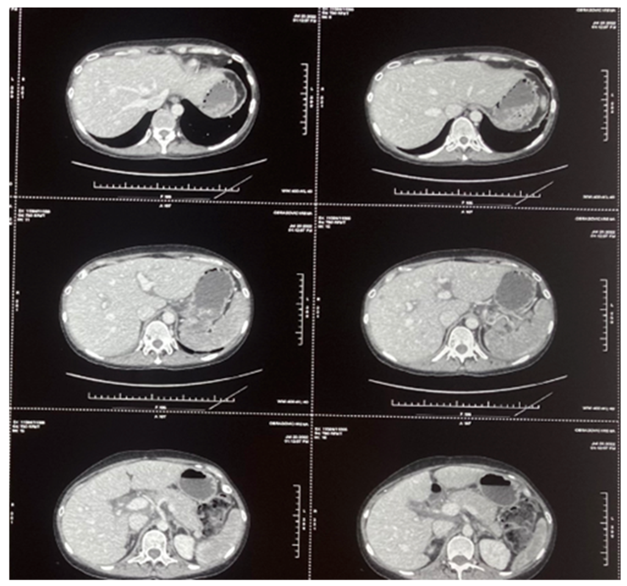Hematolrep 17 00043 g002