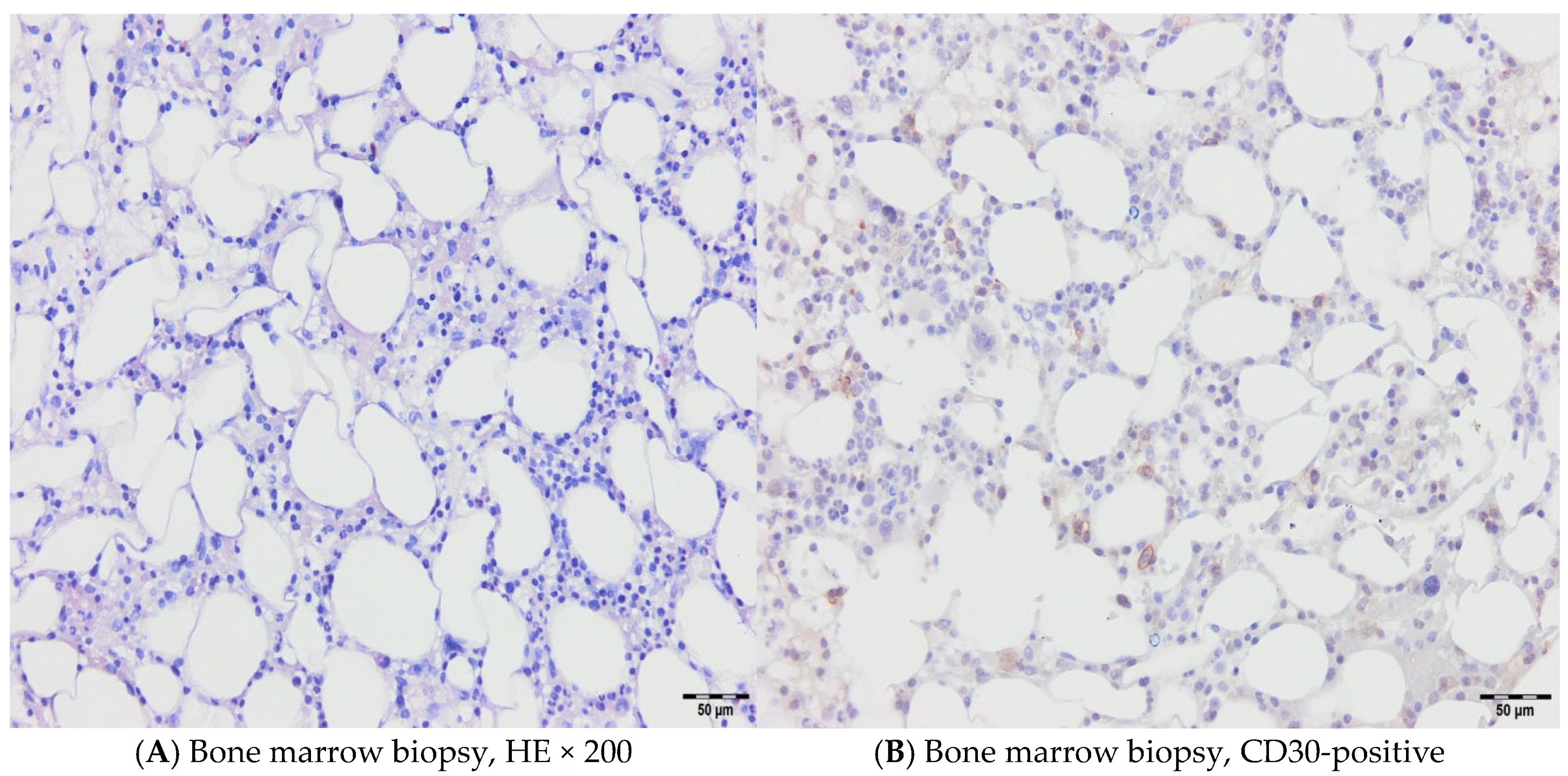 Hematolrep 17 00043 g003