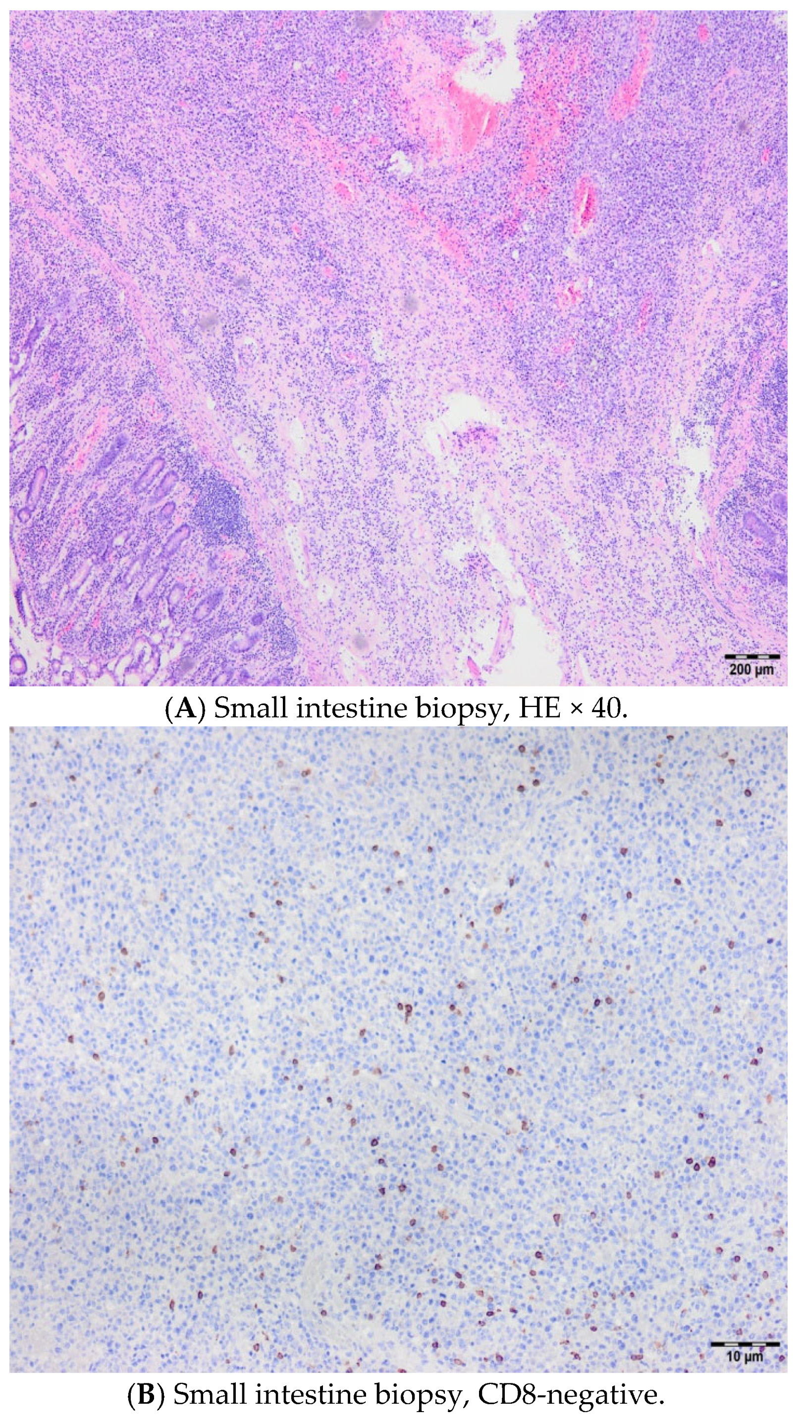 Hematolrep 17 00043 g005a