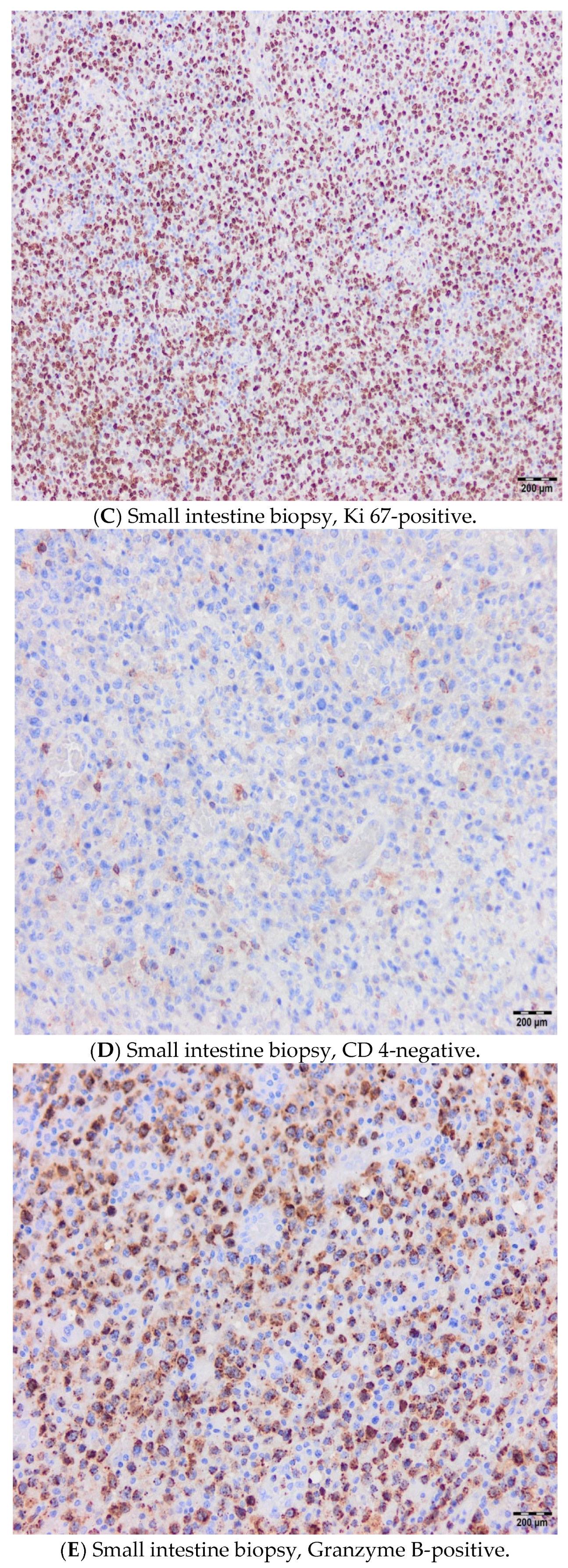Hematolrep 17 00043 g005b