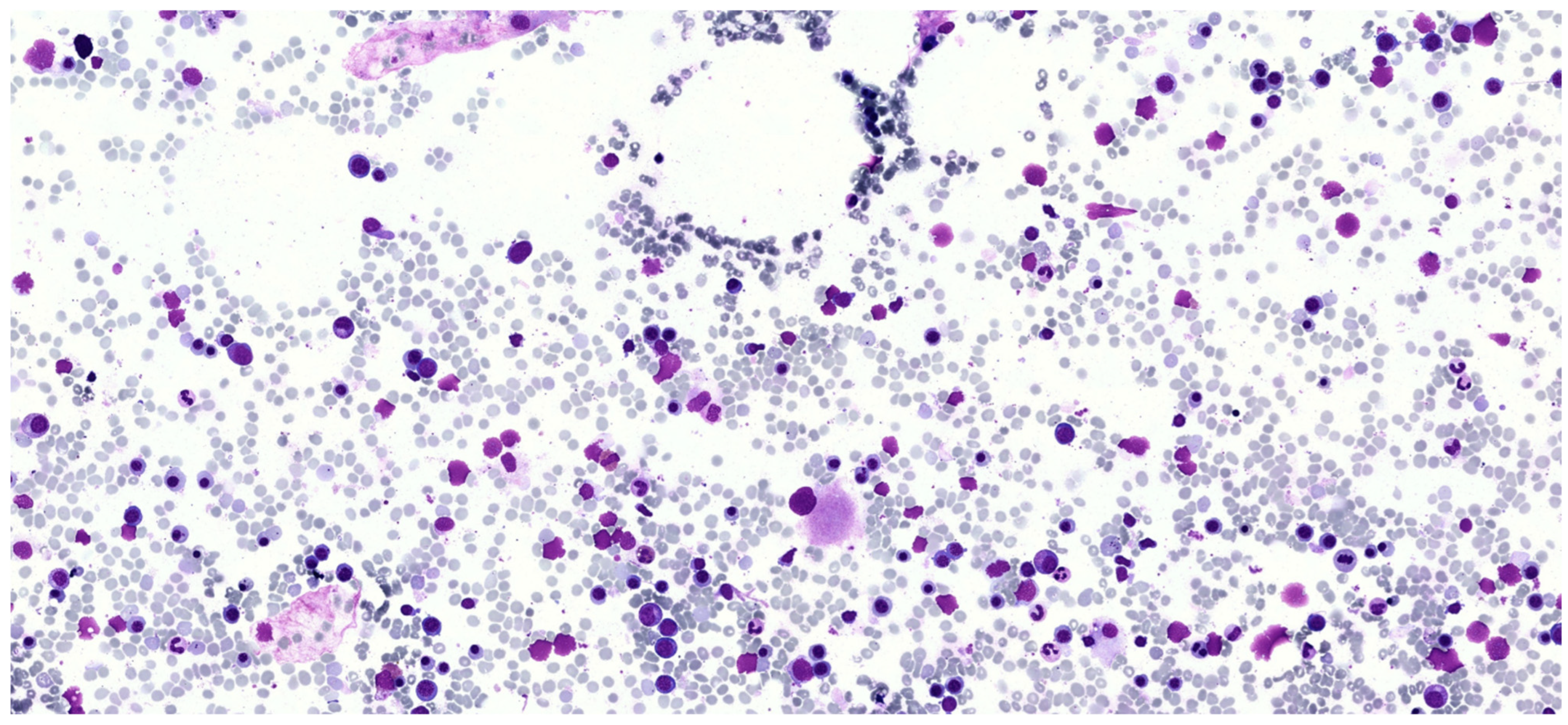 Hematolrep 17 00064 g001