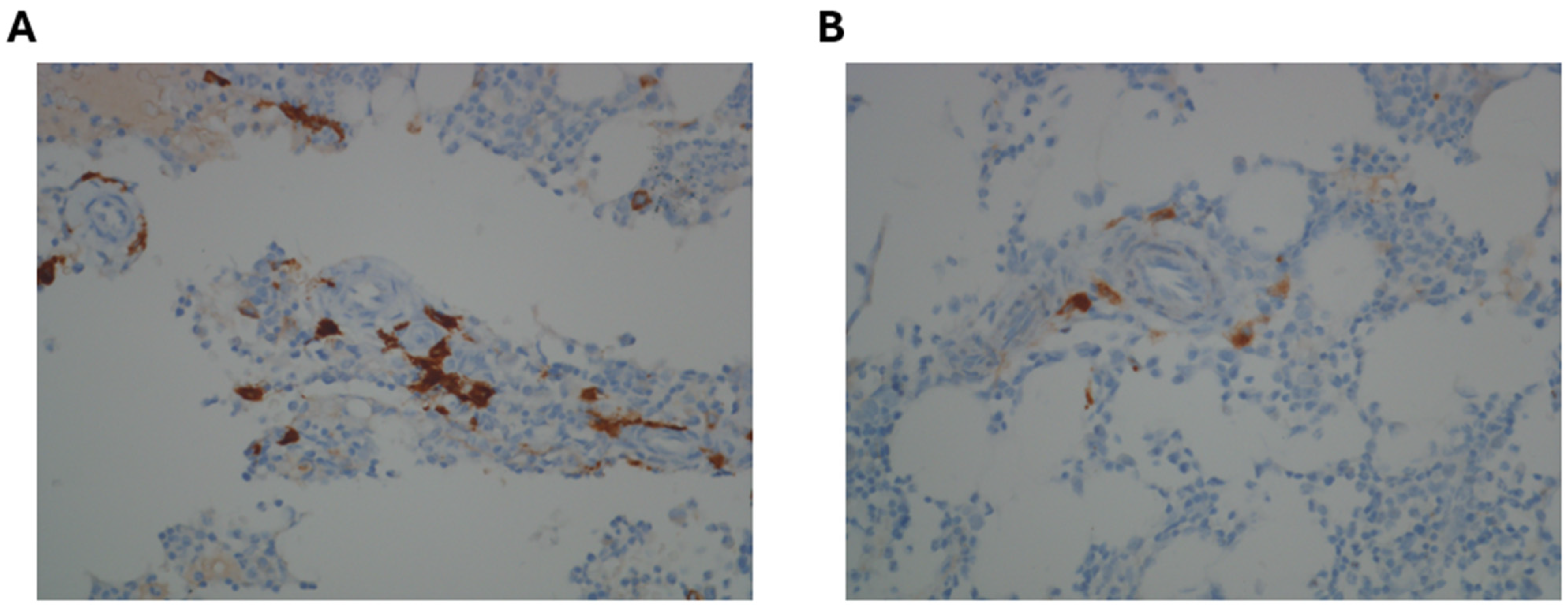 Hematolrep 17 00064 g002