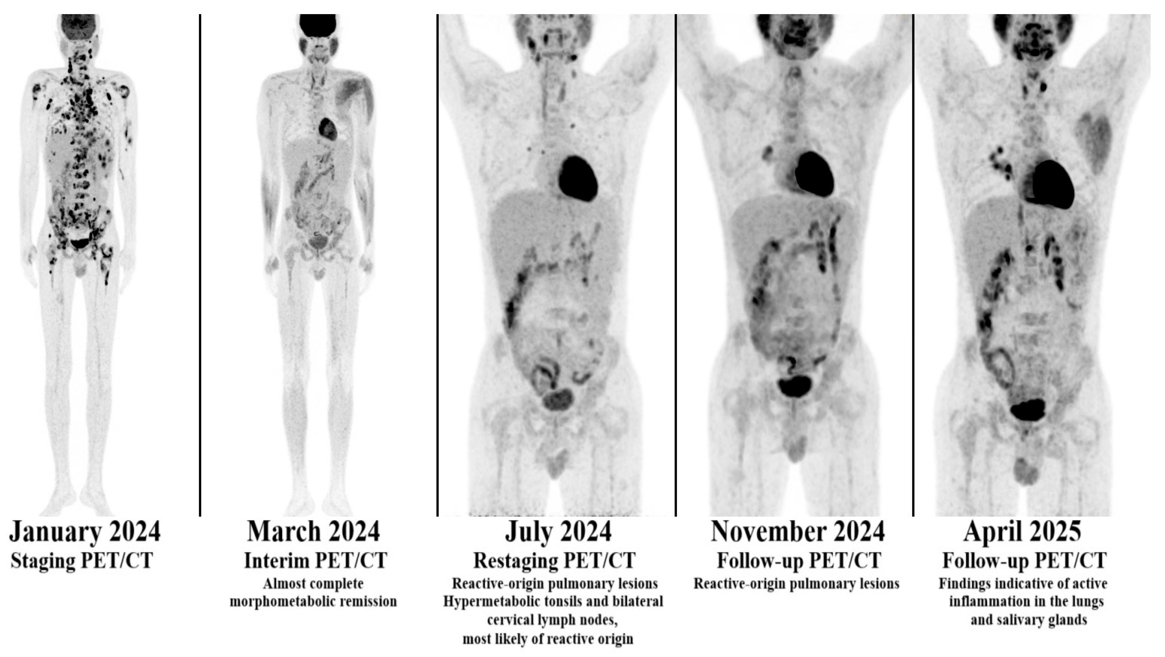 Hematolrep 17 00065 g002