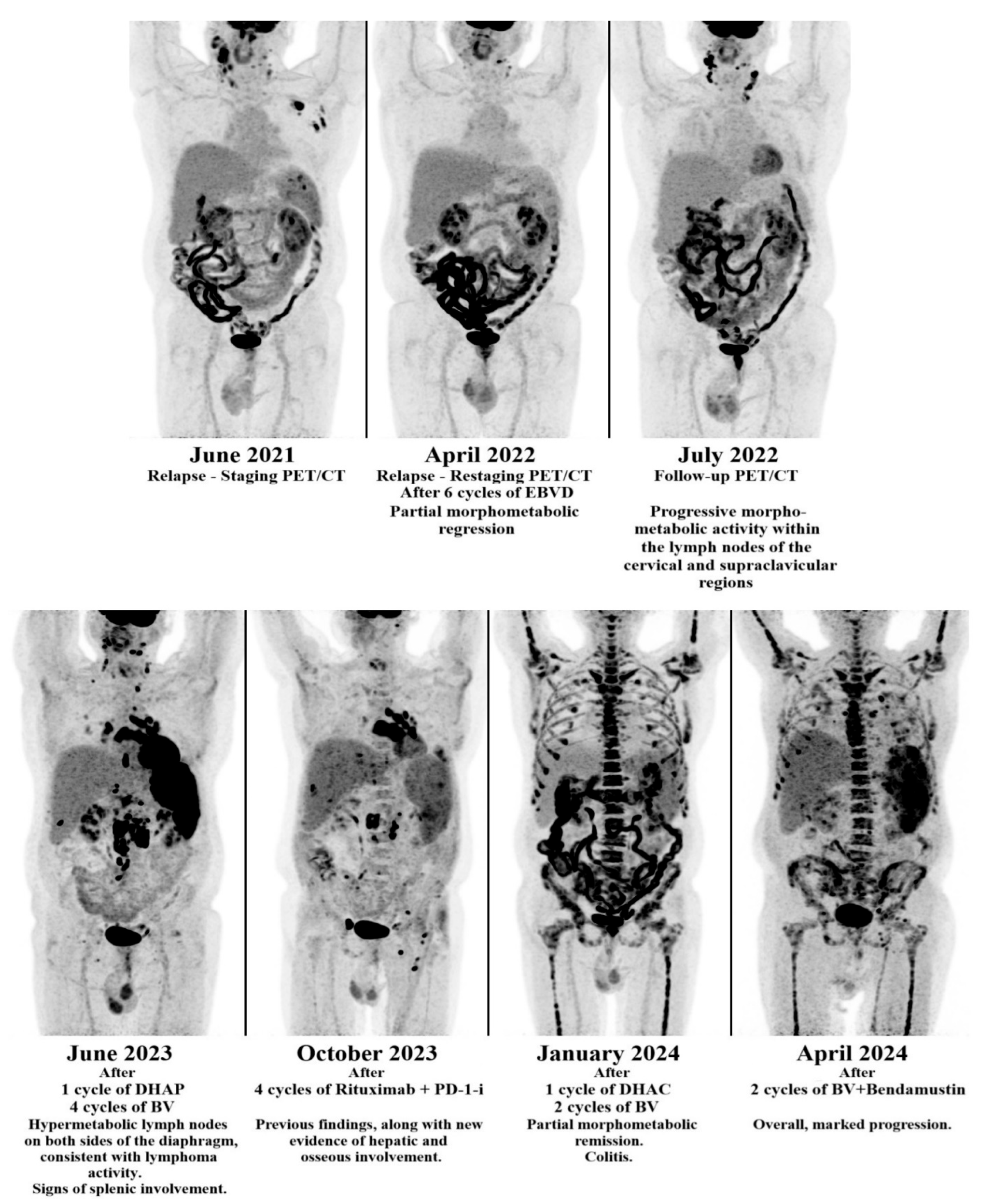 Hematolrep 17 00065 g004
