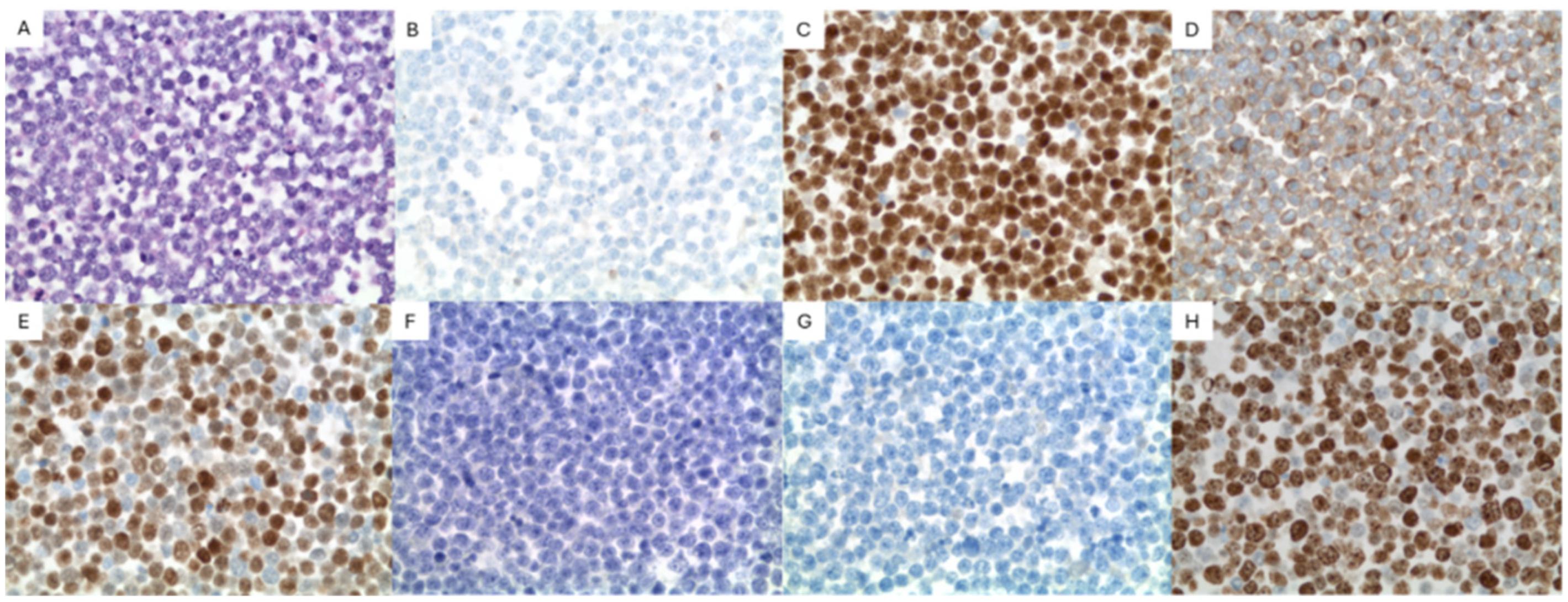 Hematolrep 18 00013 g002 Hematolrep 18 00013 g002