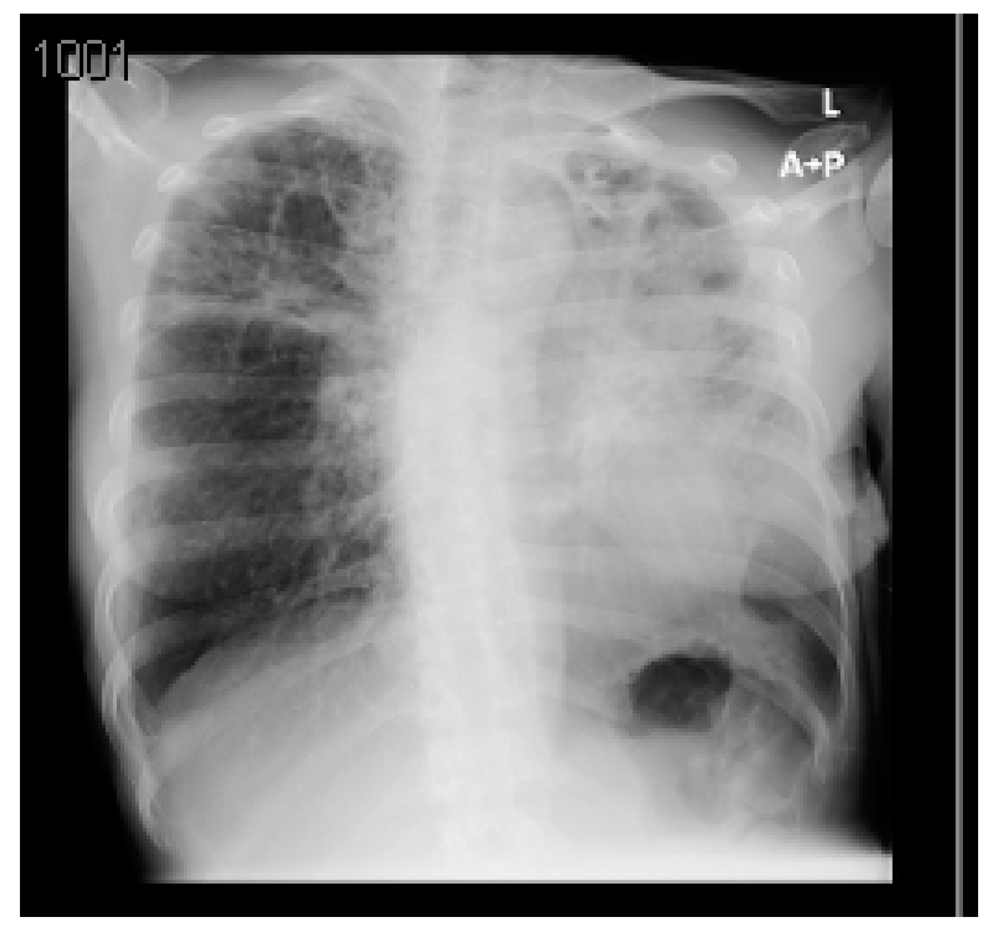 Hygiene 03 00001 g004 550