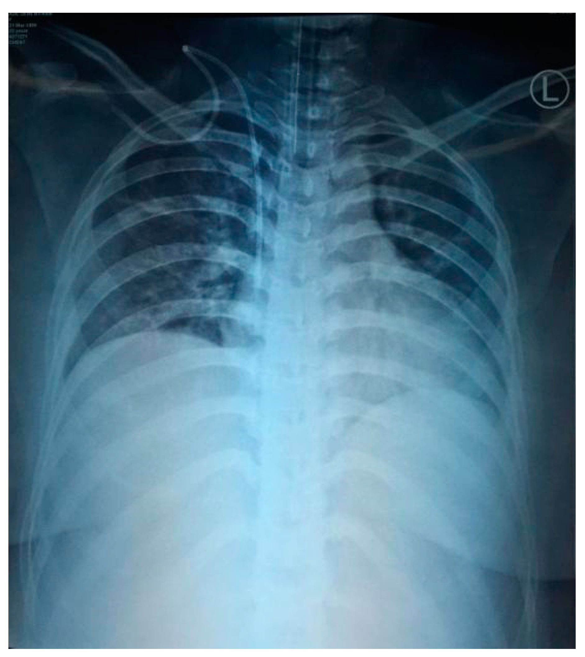 Idr 12 00013 g002 Idr 12 00013 g002