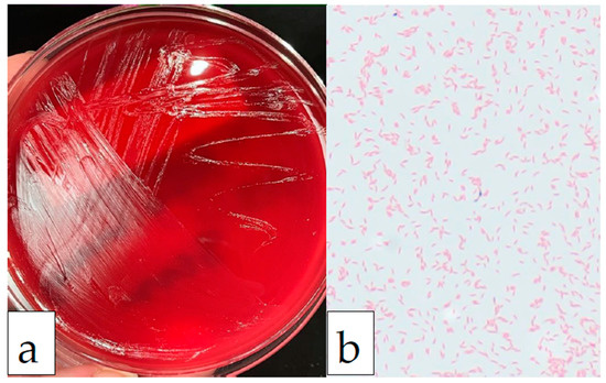 Infectious Disease Reports Free FullText Mobiluncus curtisii