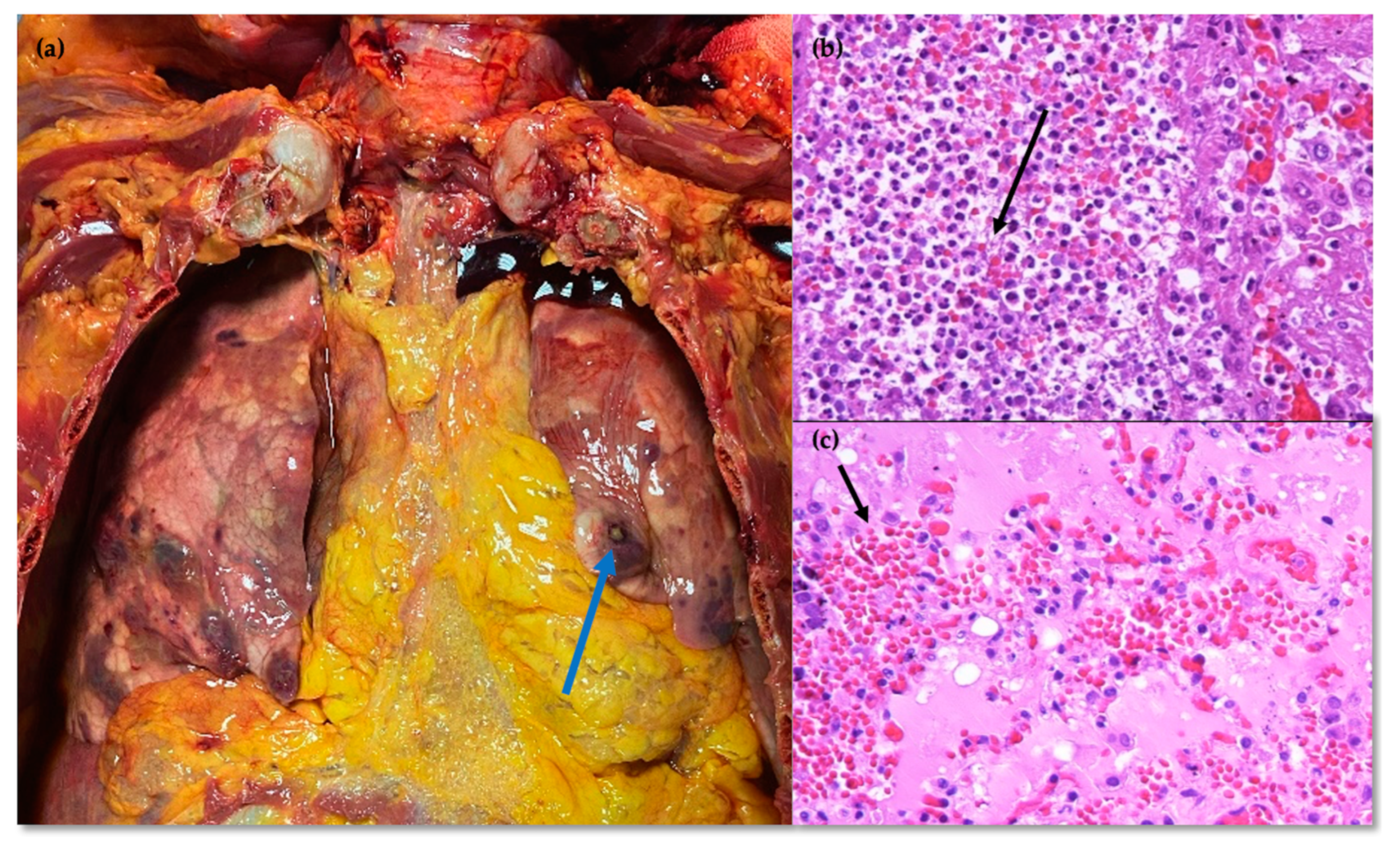 Idr 16 00100 g004 Idr 16 00100 g004