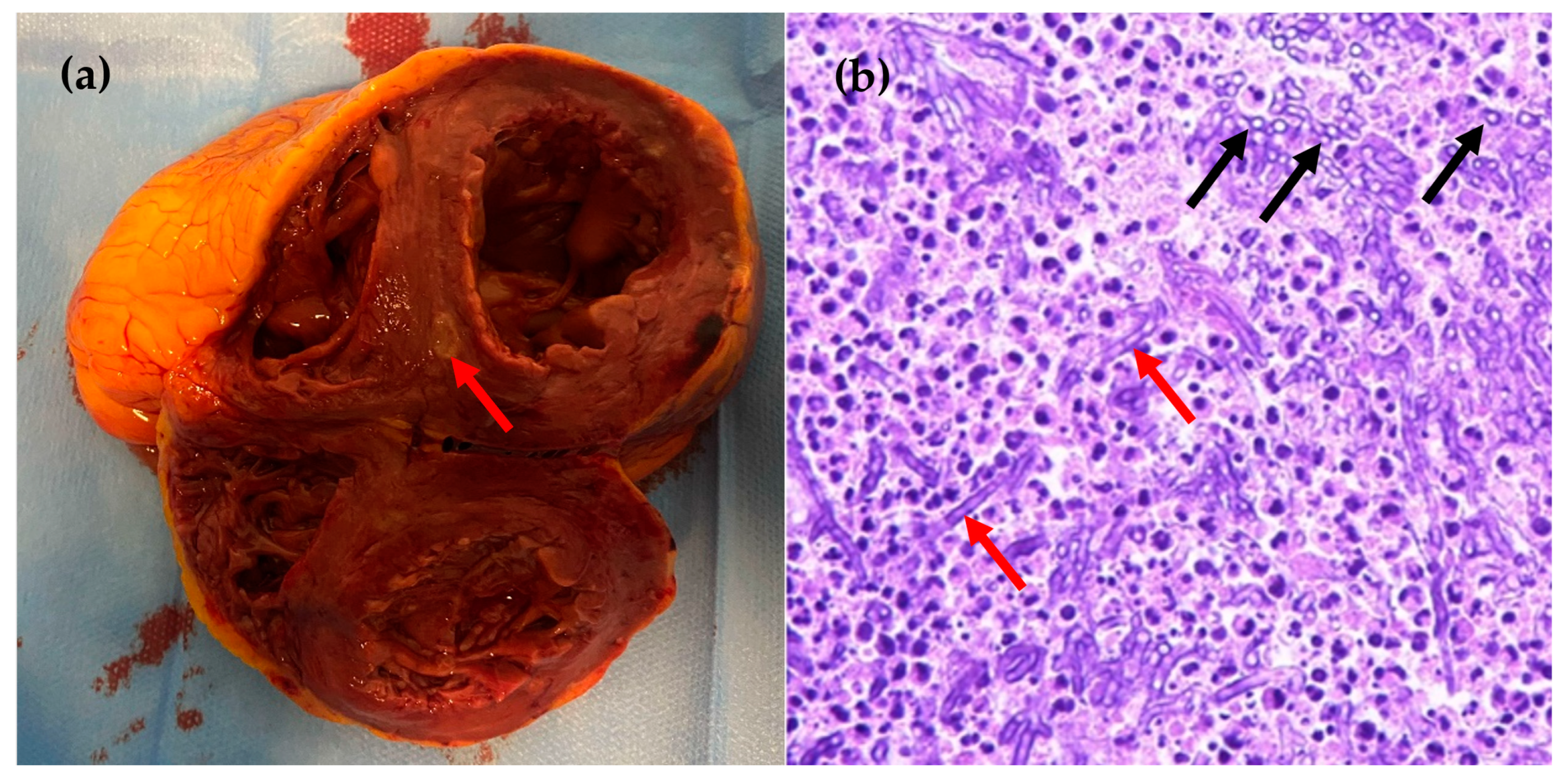 Idr 16 00100 g005 Idr 16 00100 g005