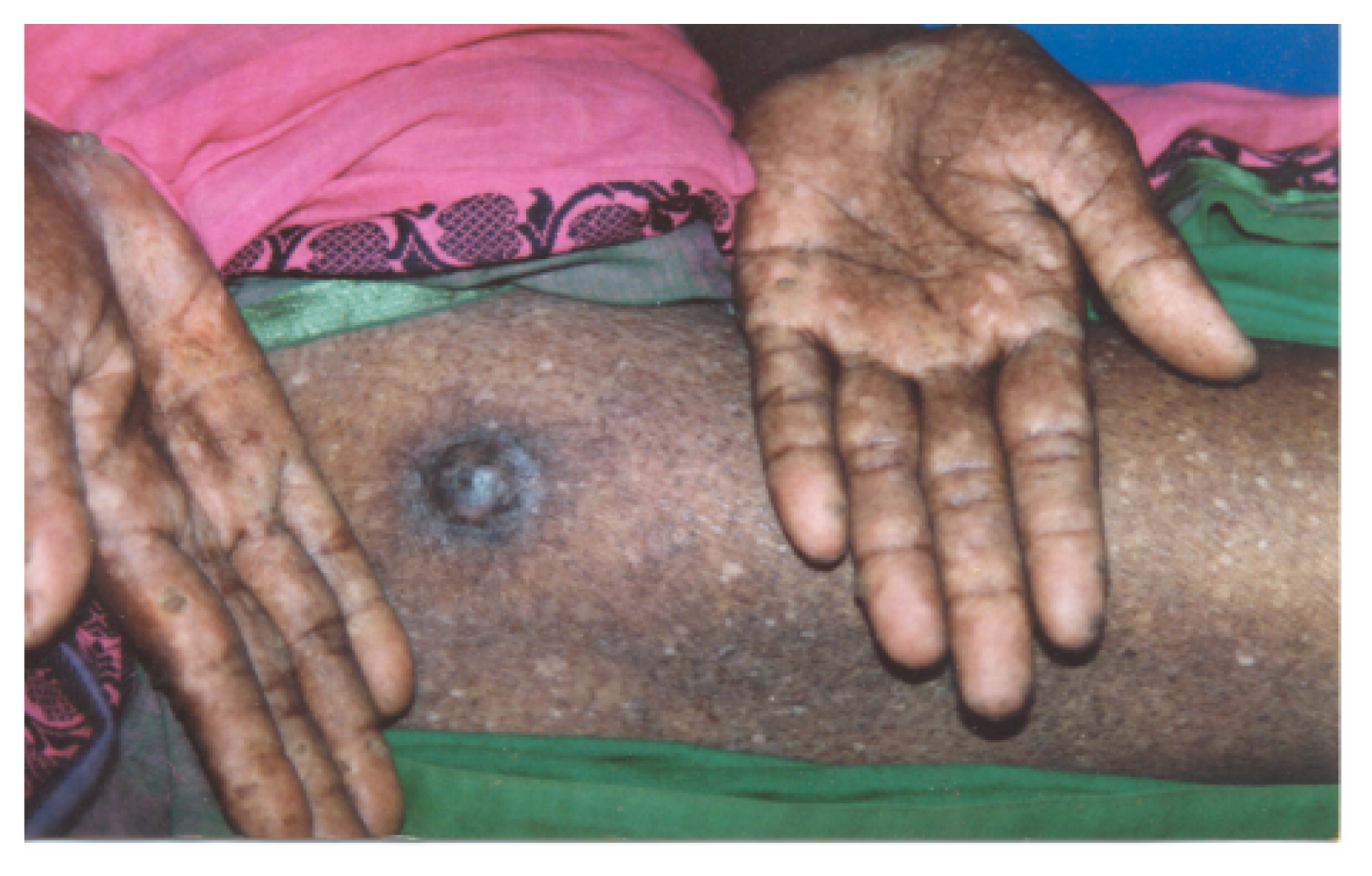 Ijerph 02 00204f4 1024