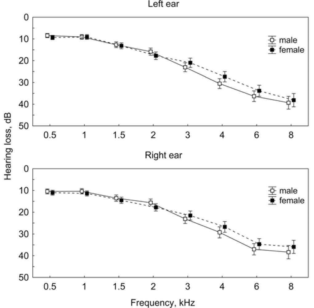 The More the Worse the Grade of Noise Induced Hearing Loss Associates with the Severity of Tinnitus