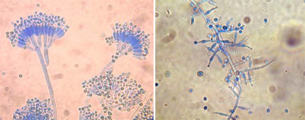IJERPH | Free Full-Text | Filamentous Fungi in Drinking Water