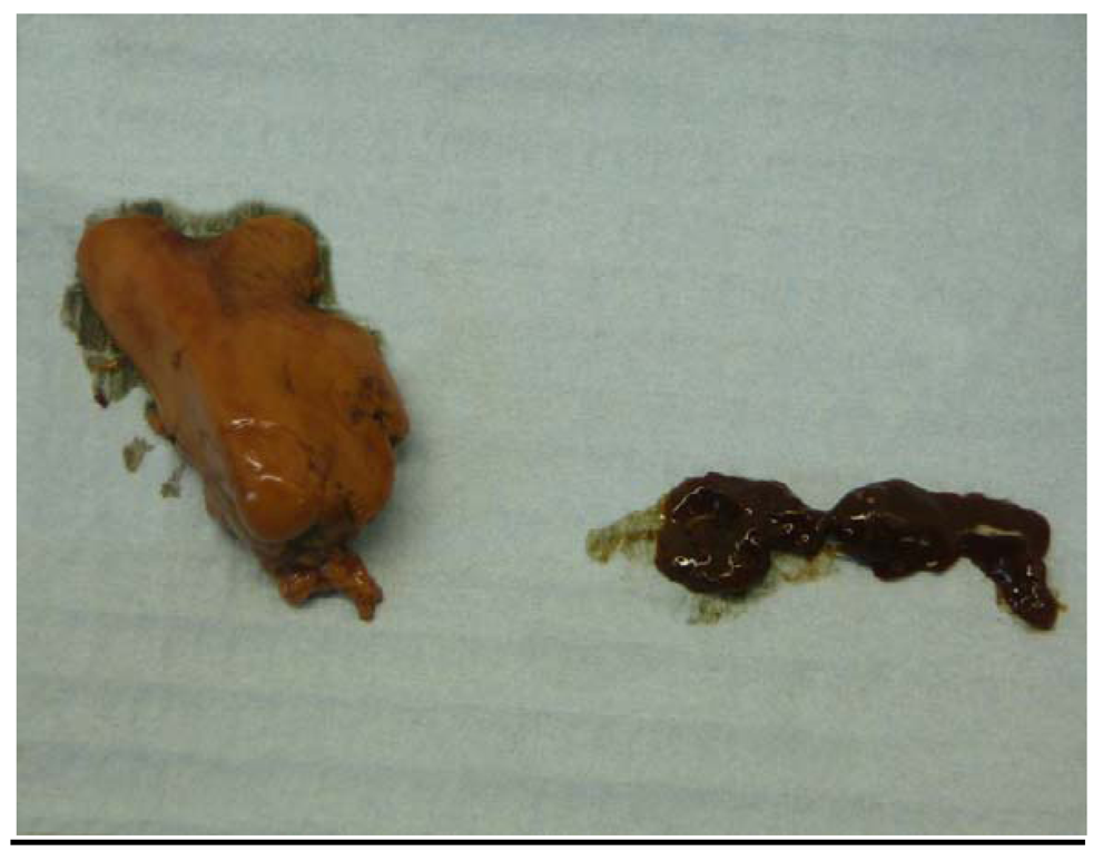 Ijerph 09 02412 g003 1024